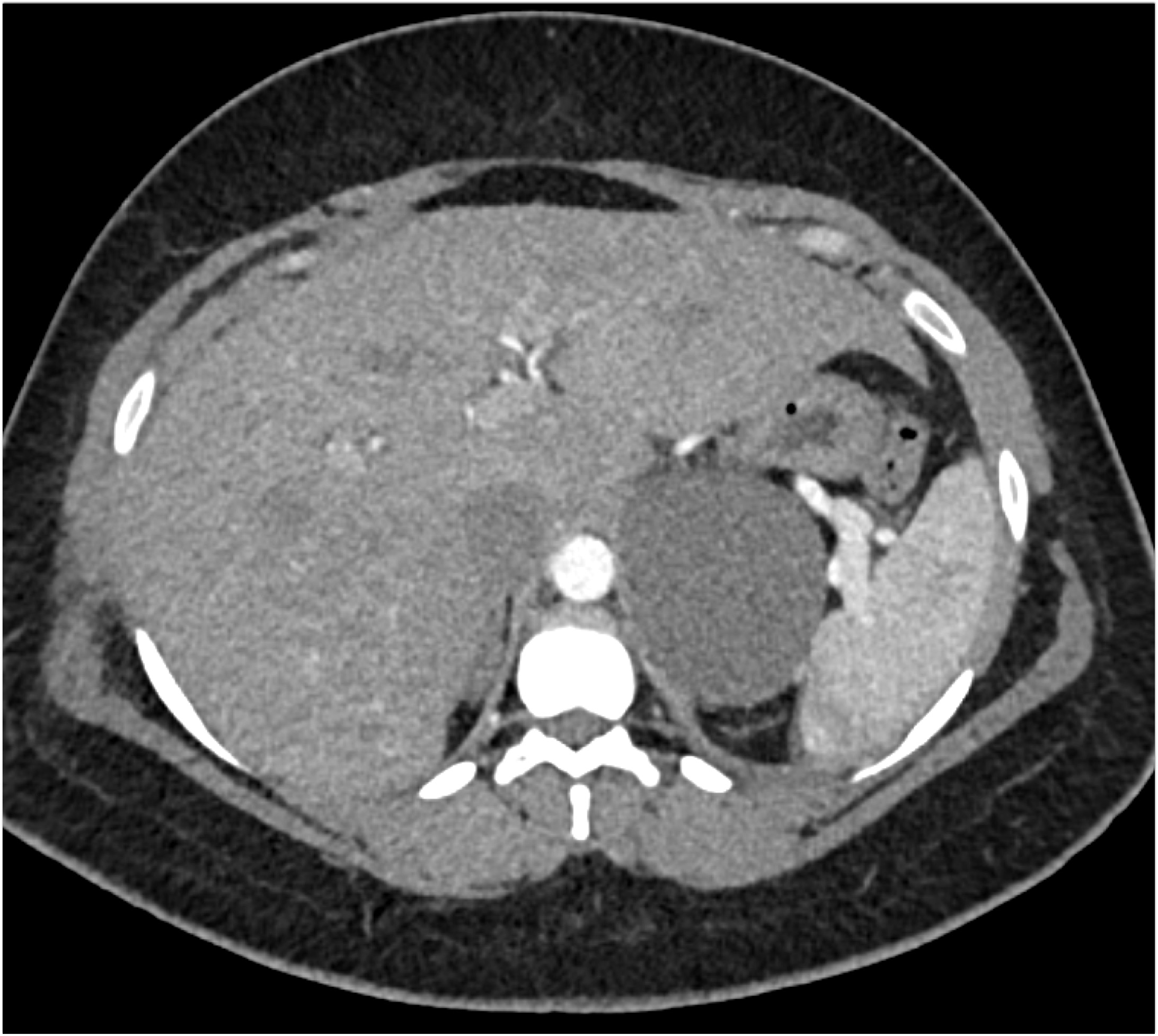 CTisus Quiz