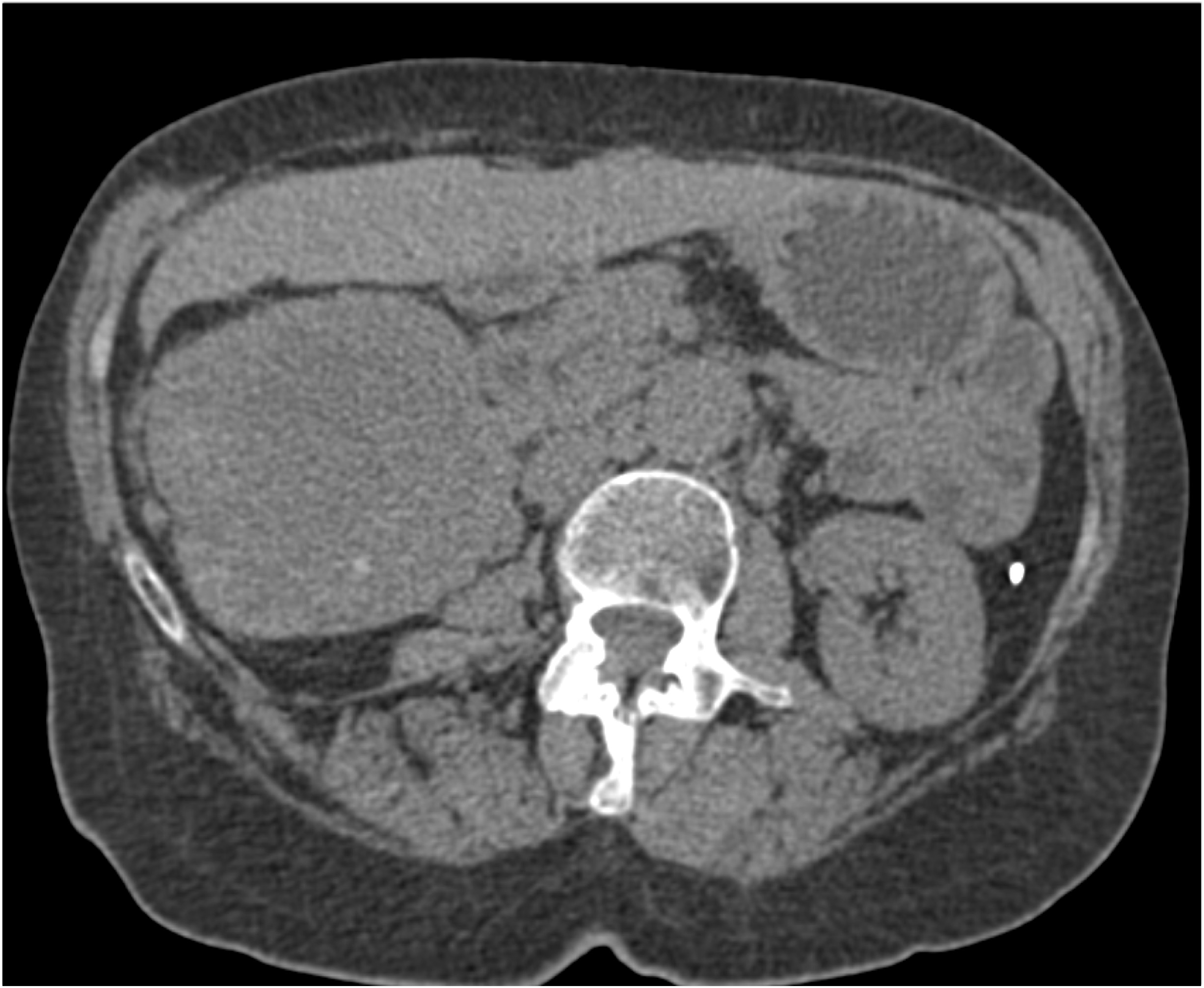 CTisus Quiz