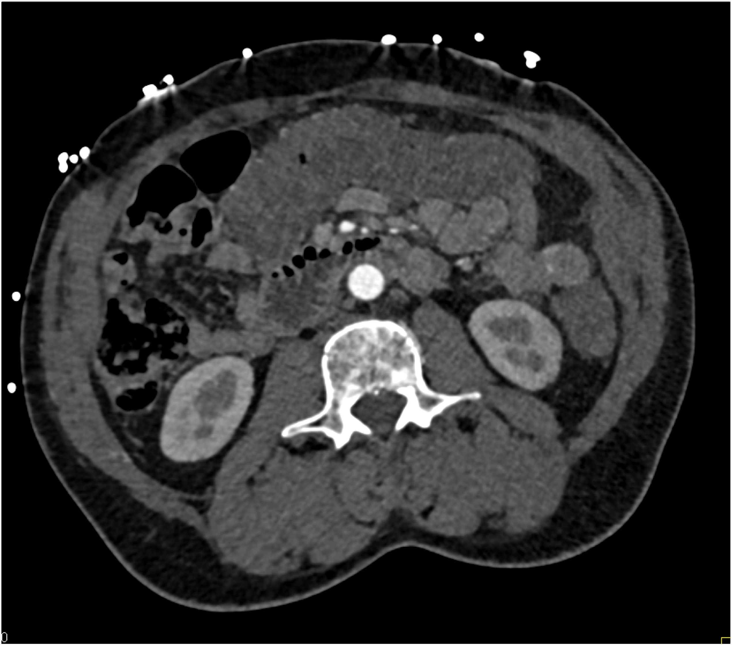 CTisus Quiz