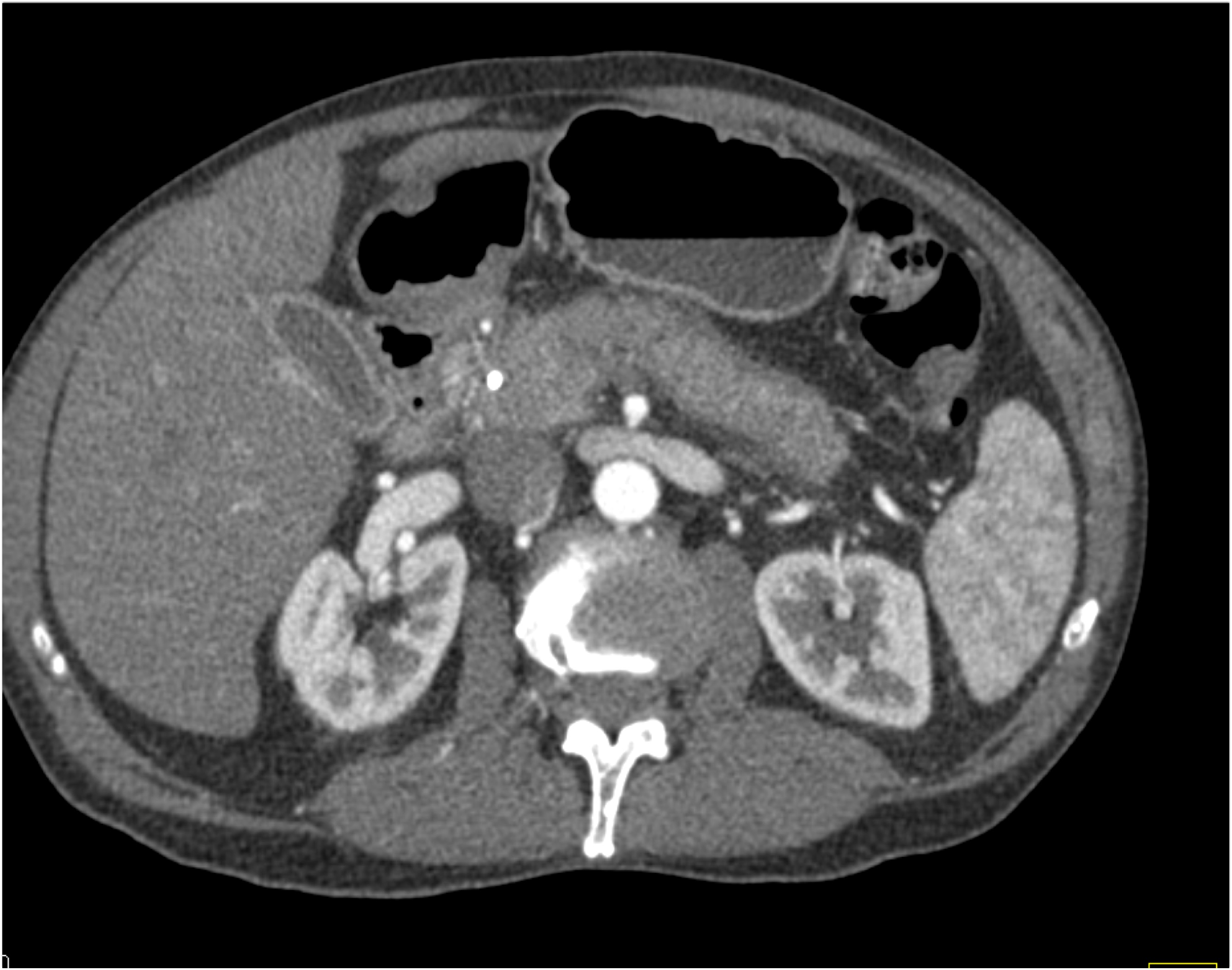 CTisus Quiz