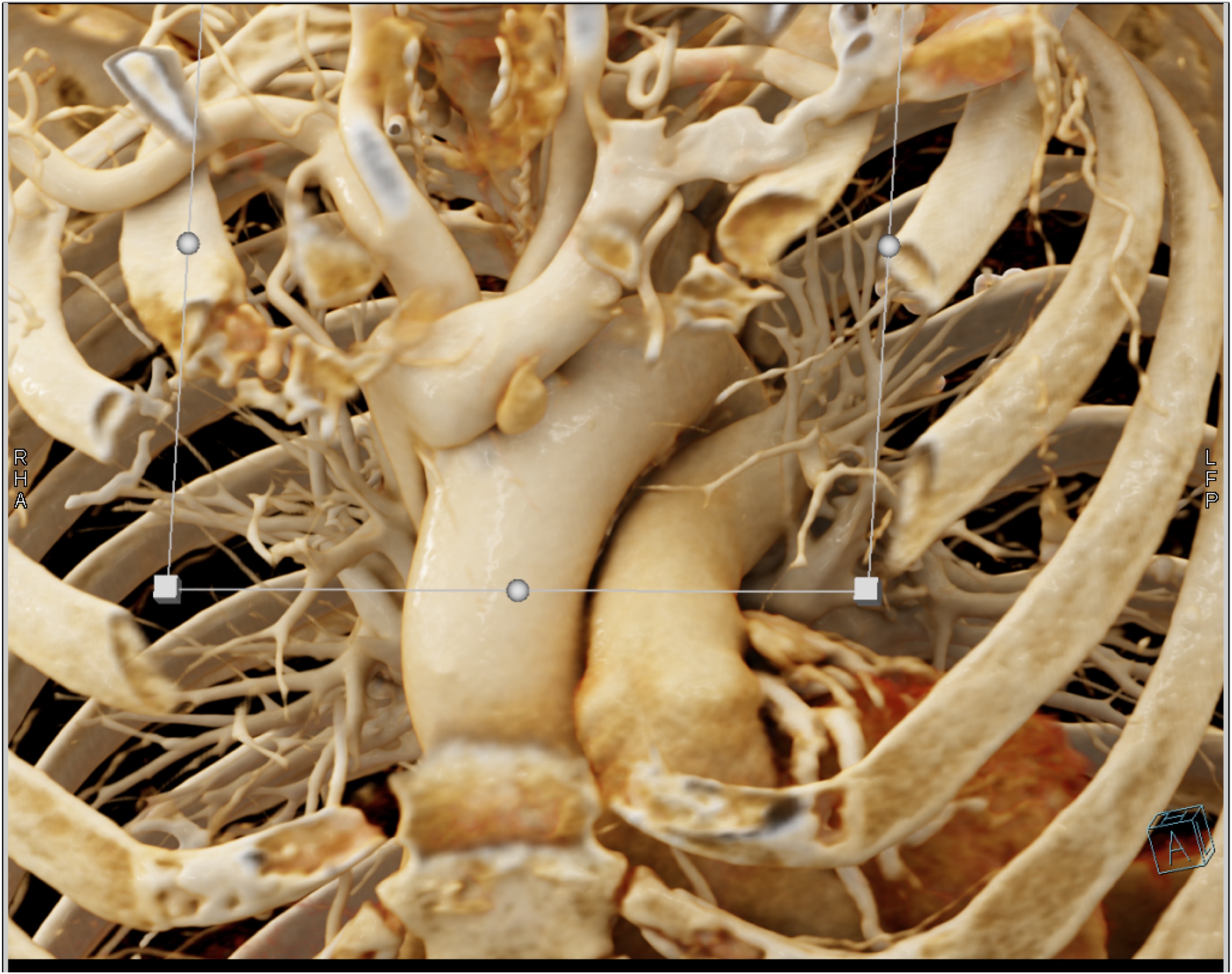 CTisus Quiz
