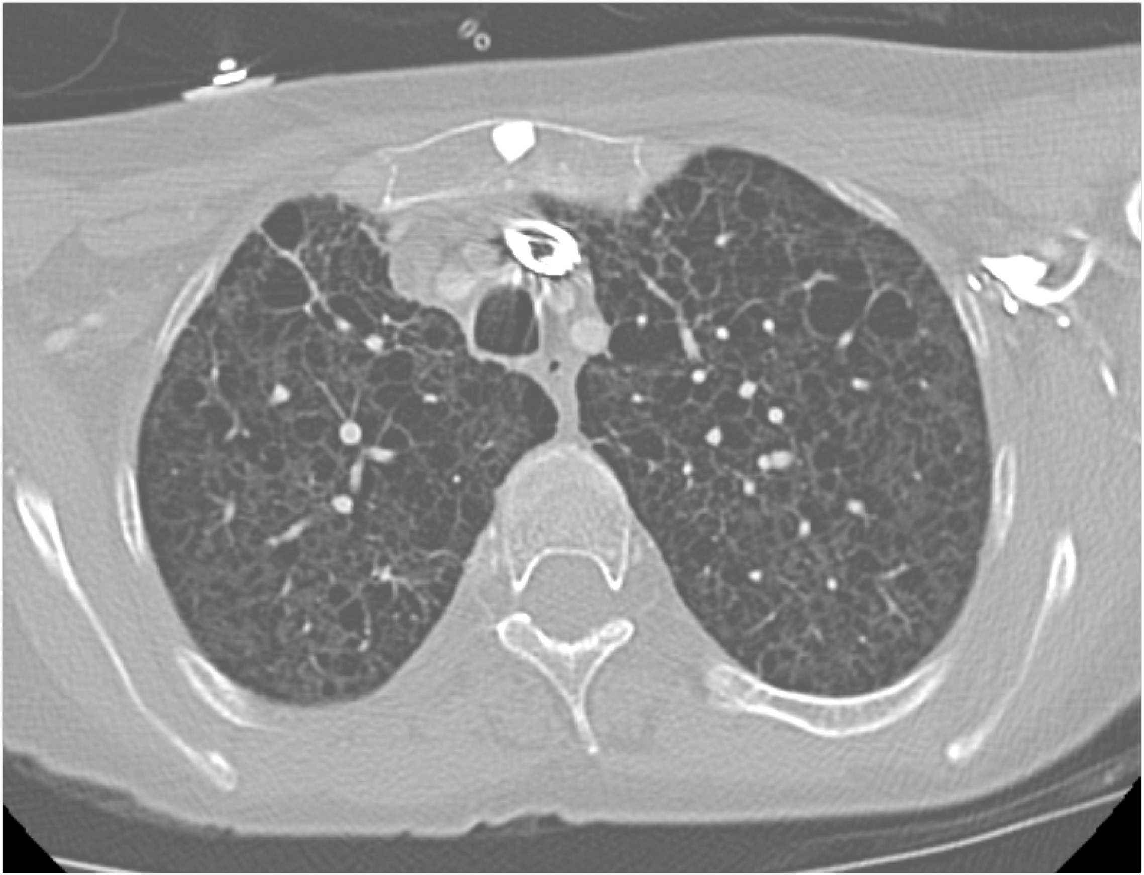 CTisus Quiz