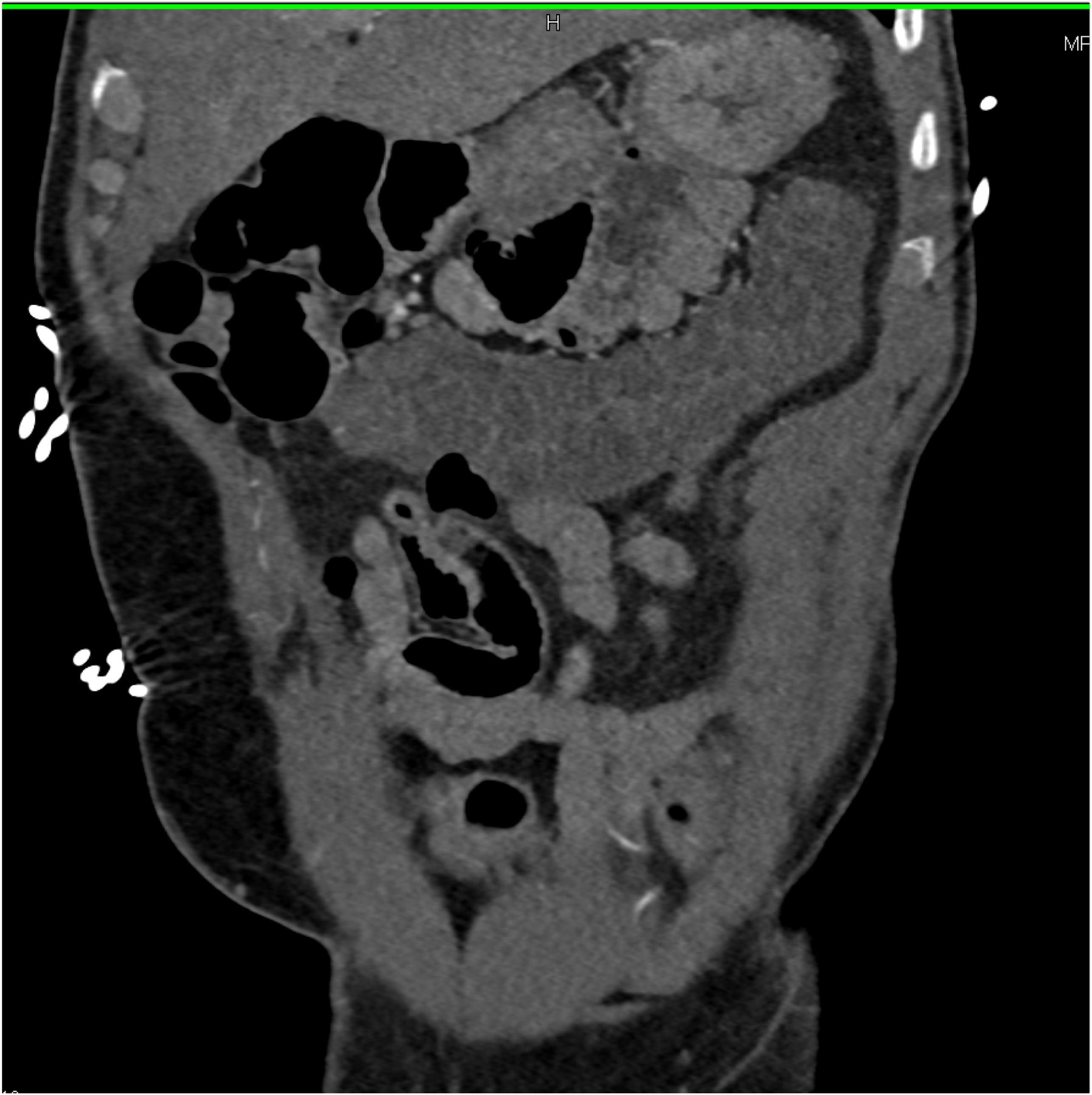 CTisus Quiz