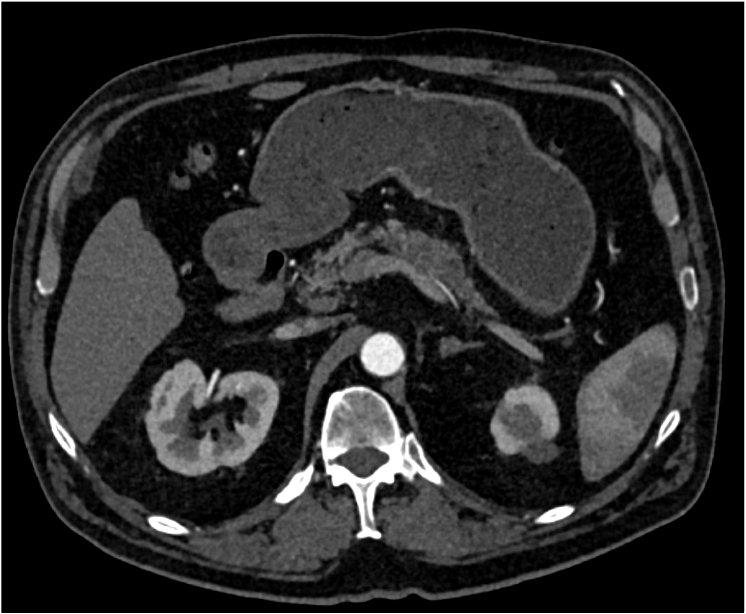 CTisus Quiz