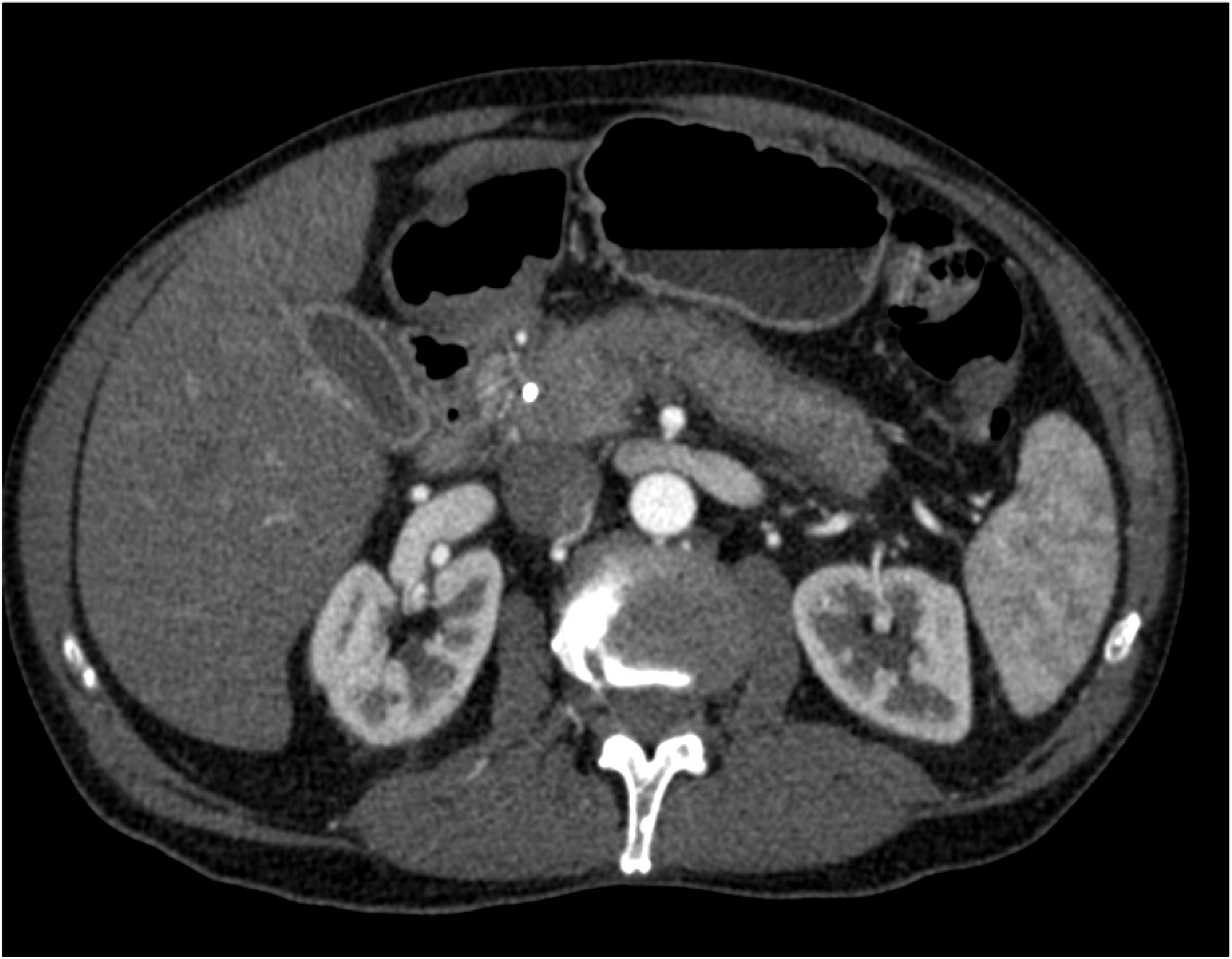 CTisus Quiz