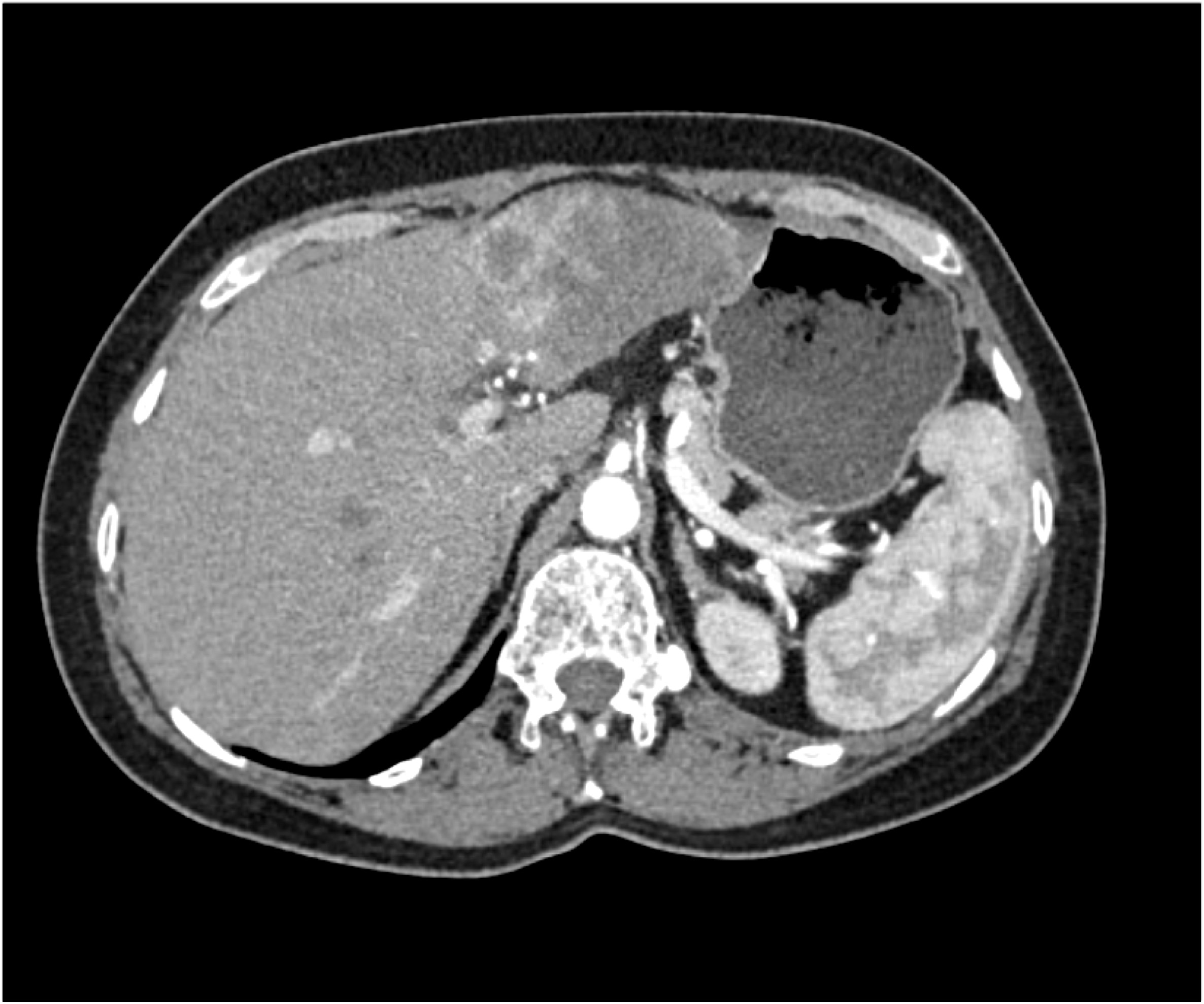 CTisus Quiz