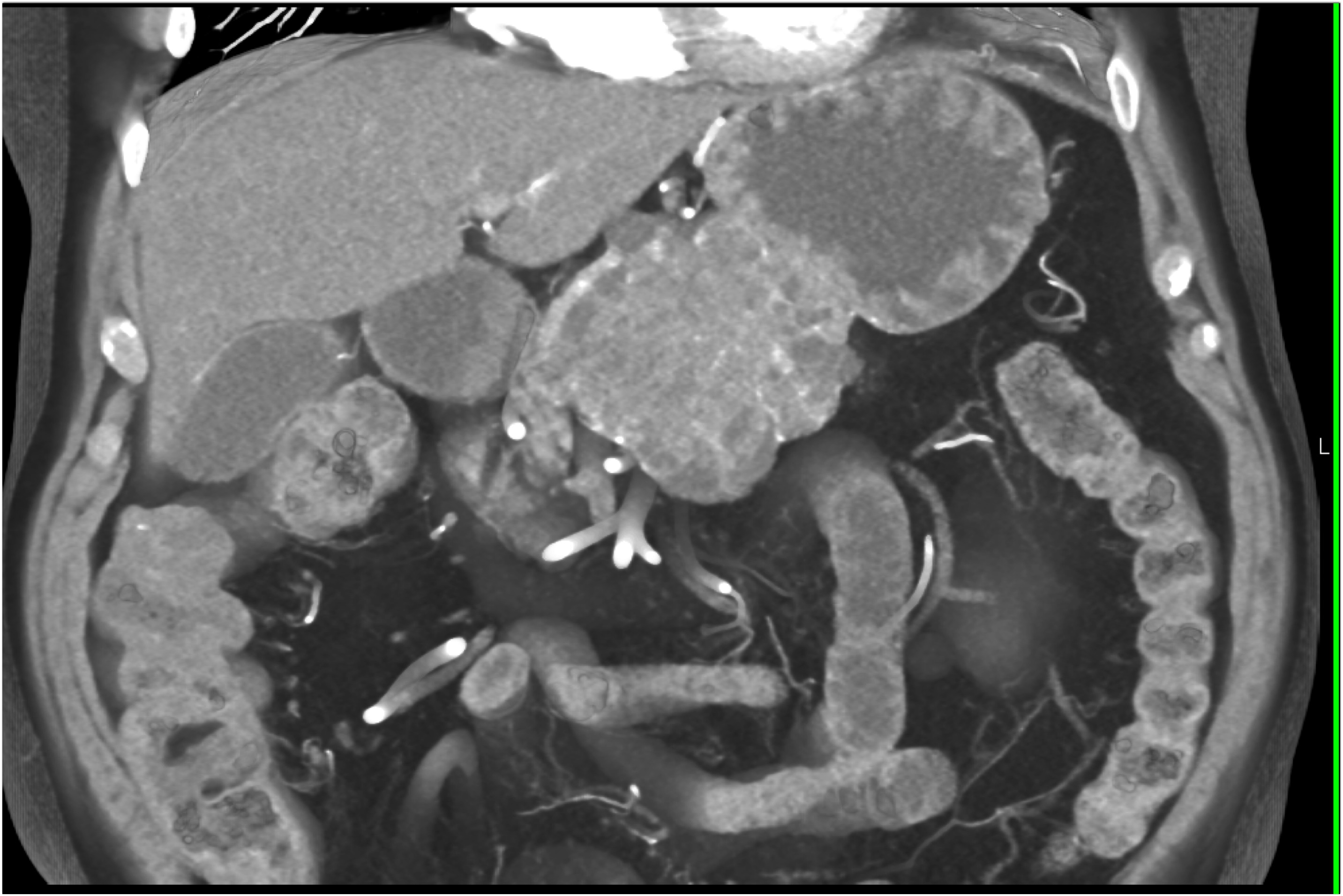 CTisus Quiz