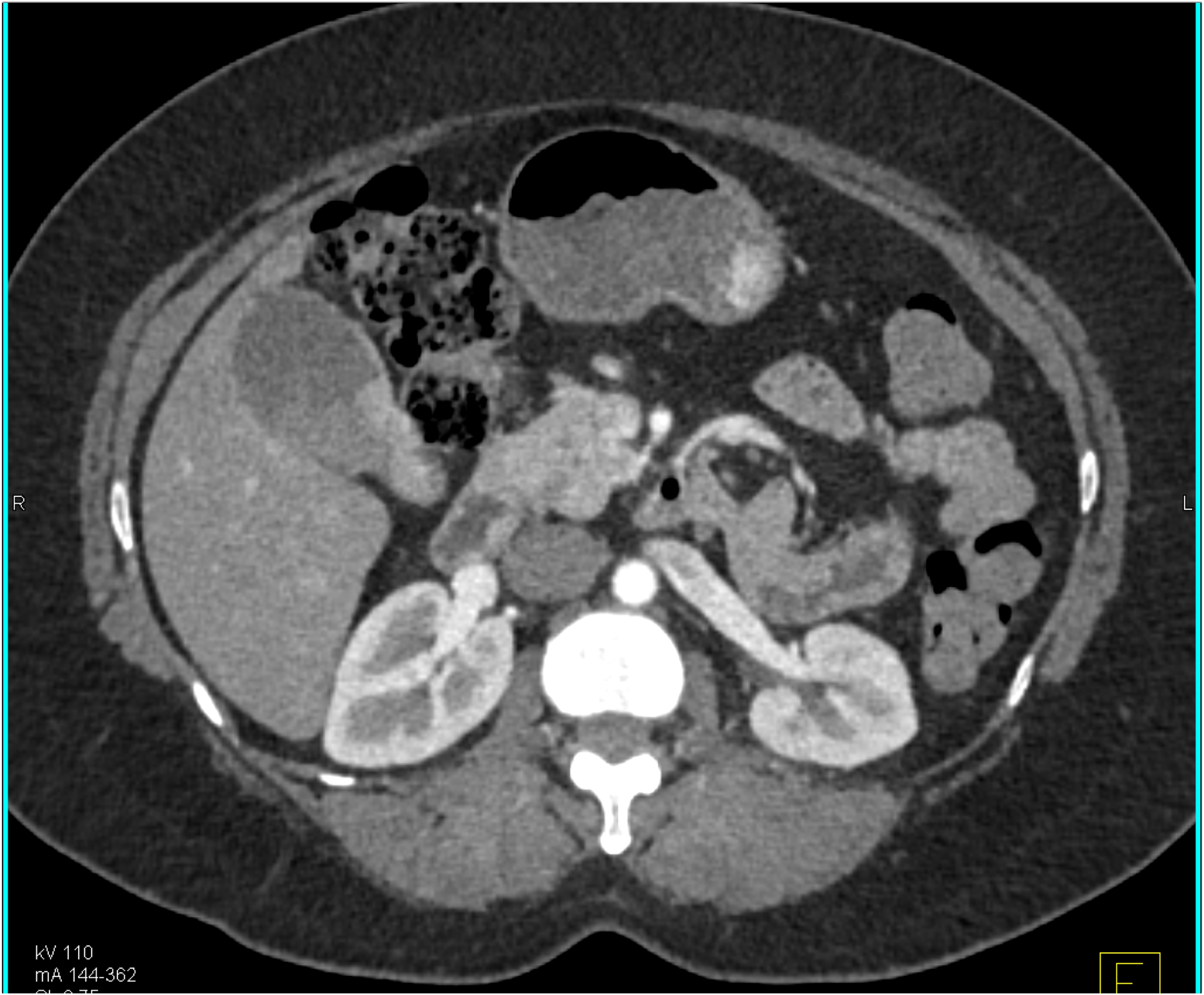 CTisus Quiz