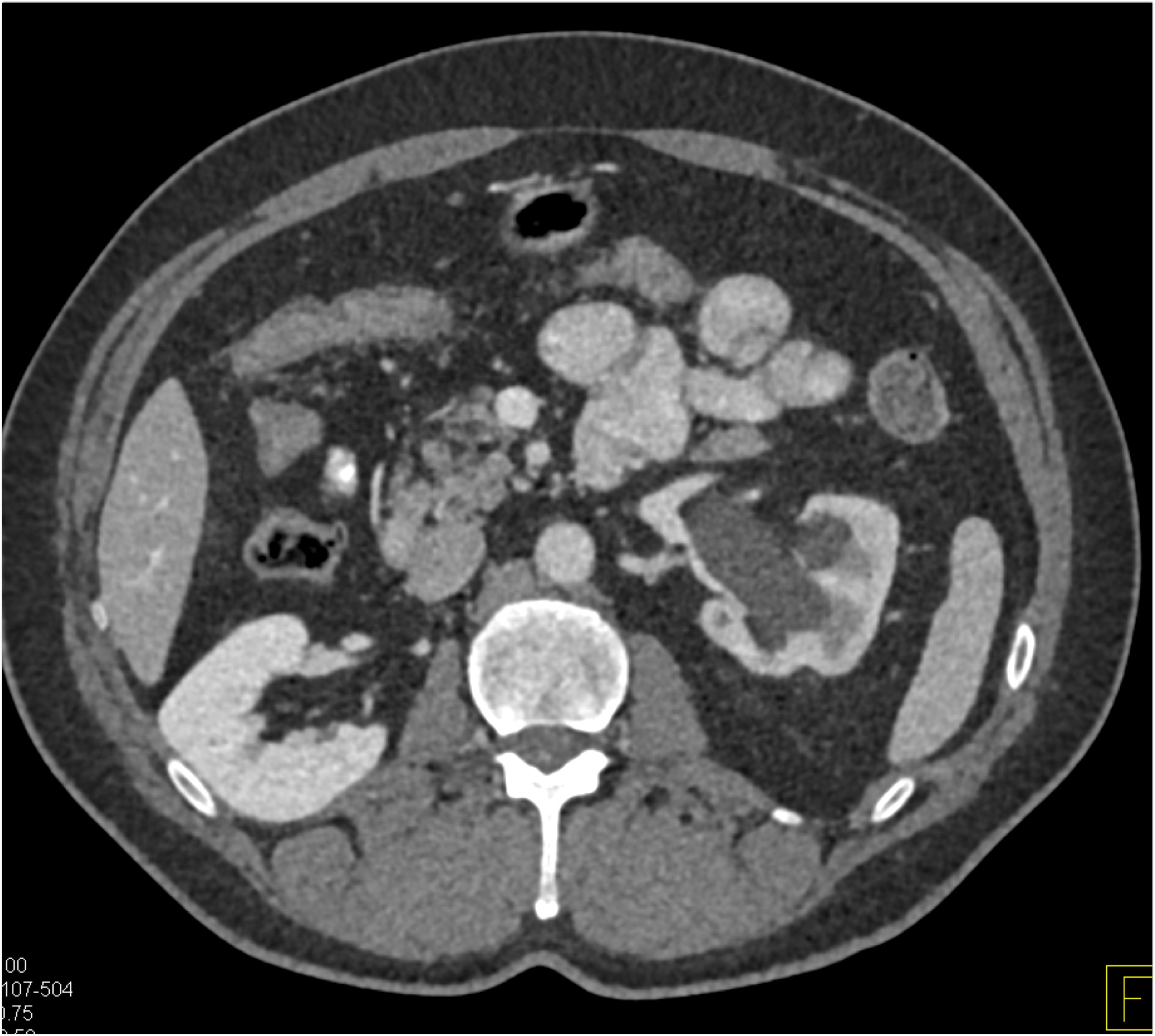 CTisus Quiz