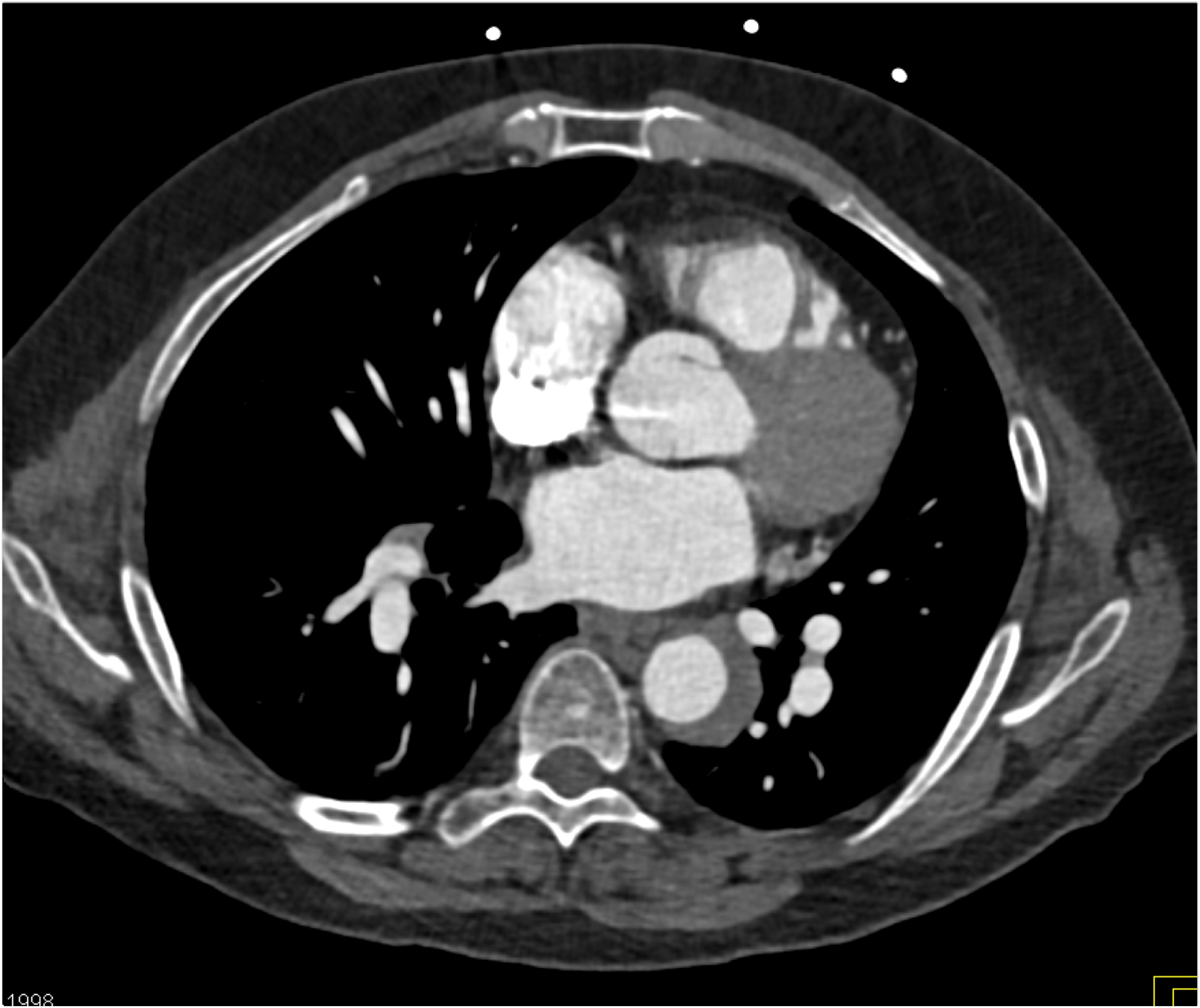 CTisus Quiz