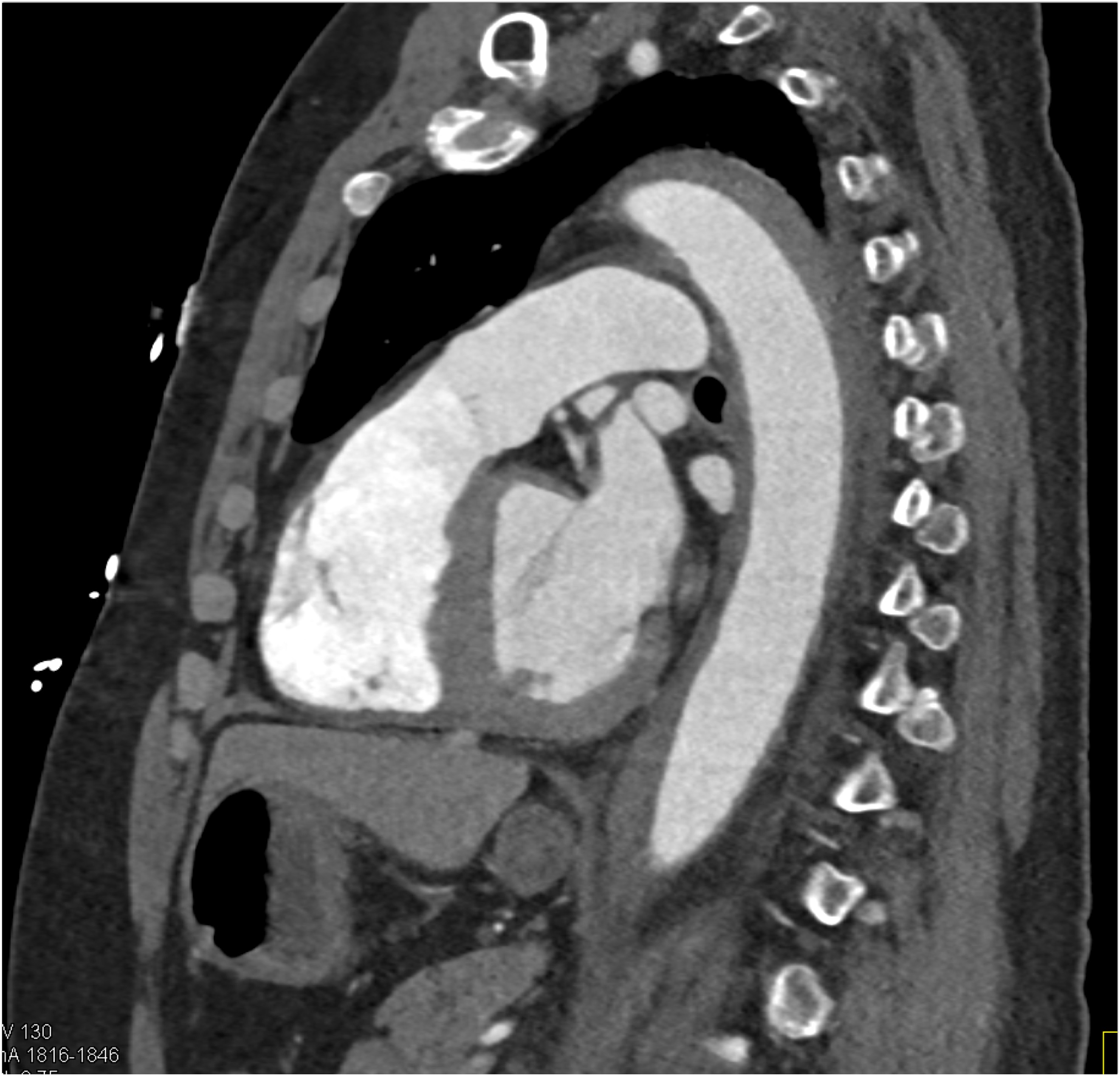 CTisus Quiz