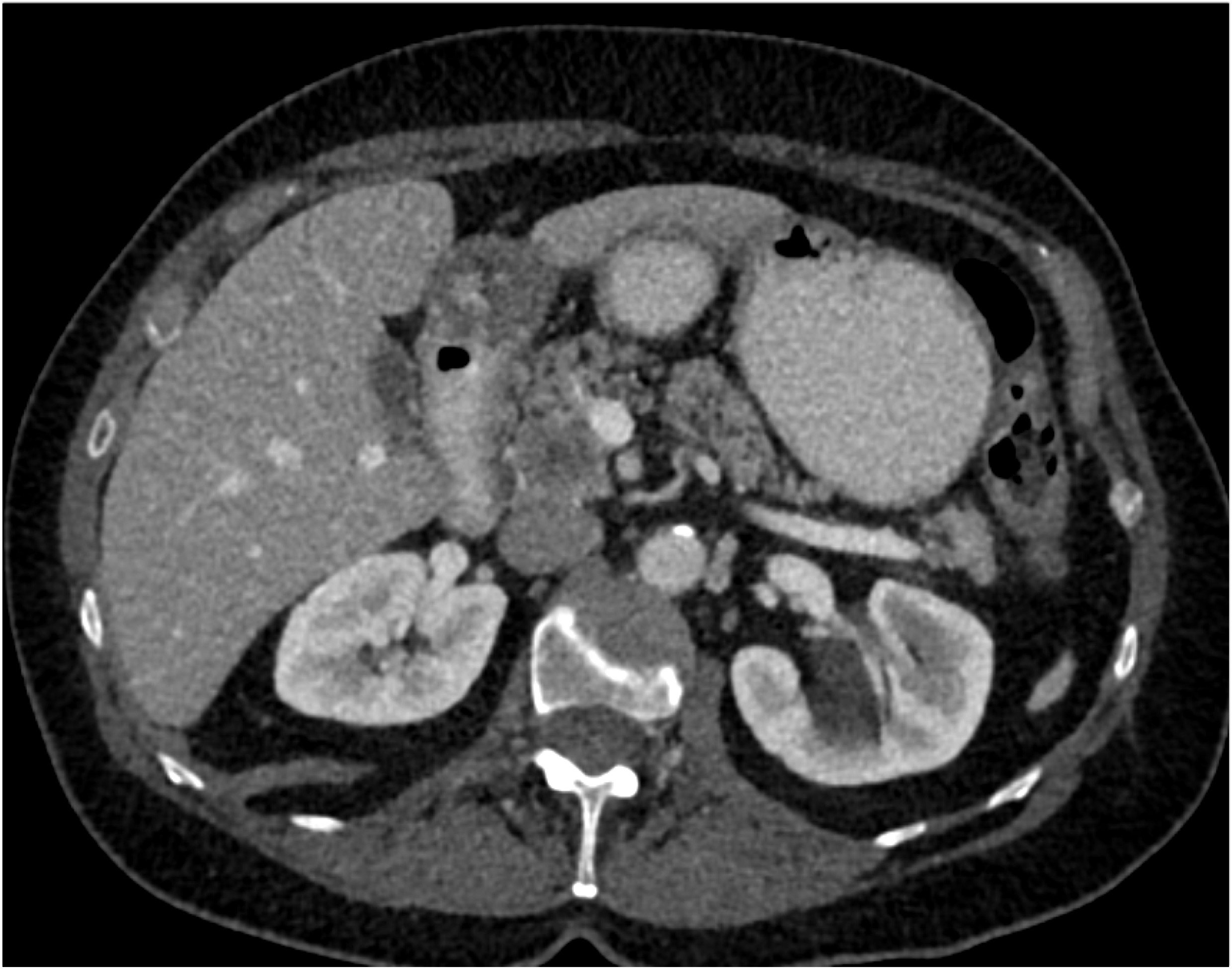 CTisus Quiz