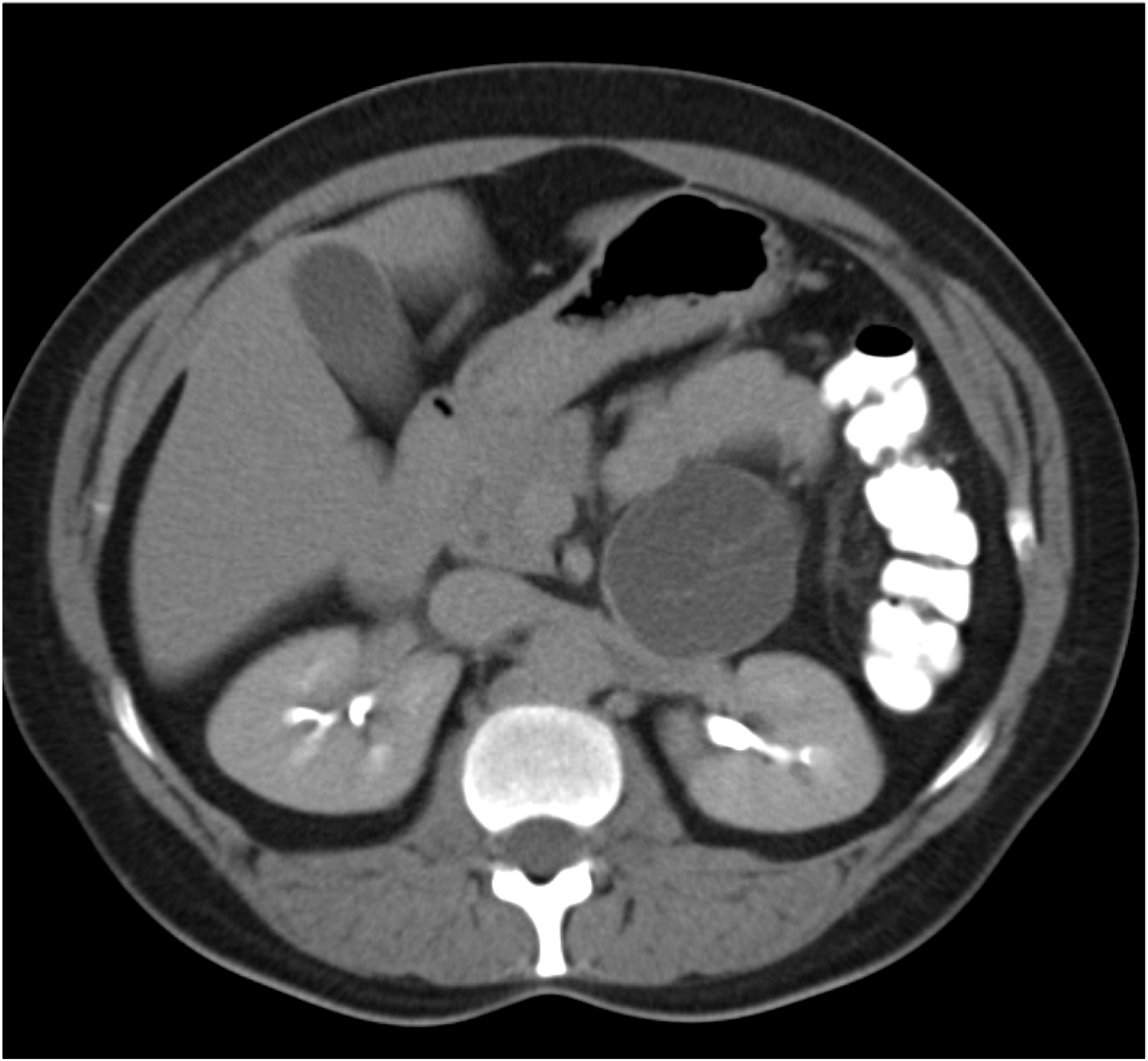 CTisus Quiz