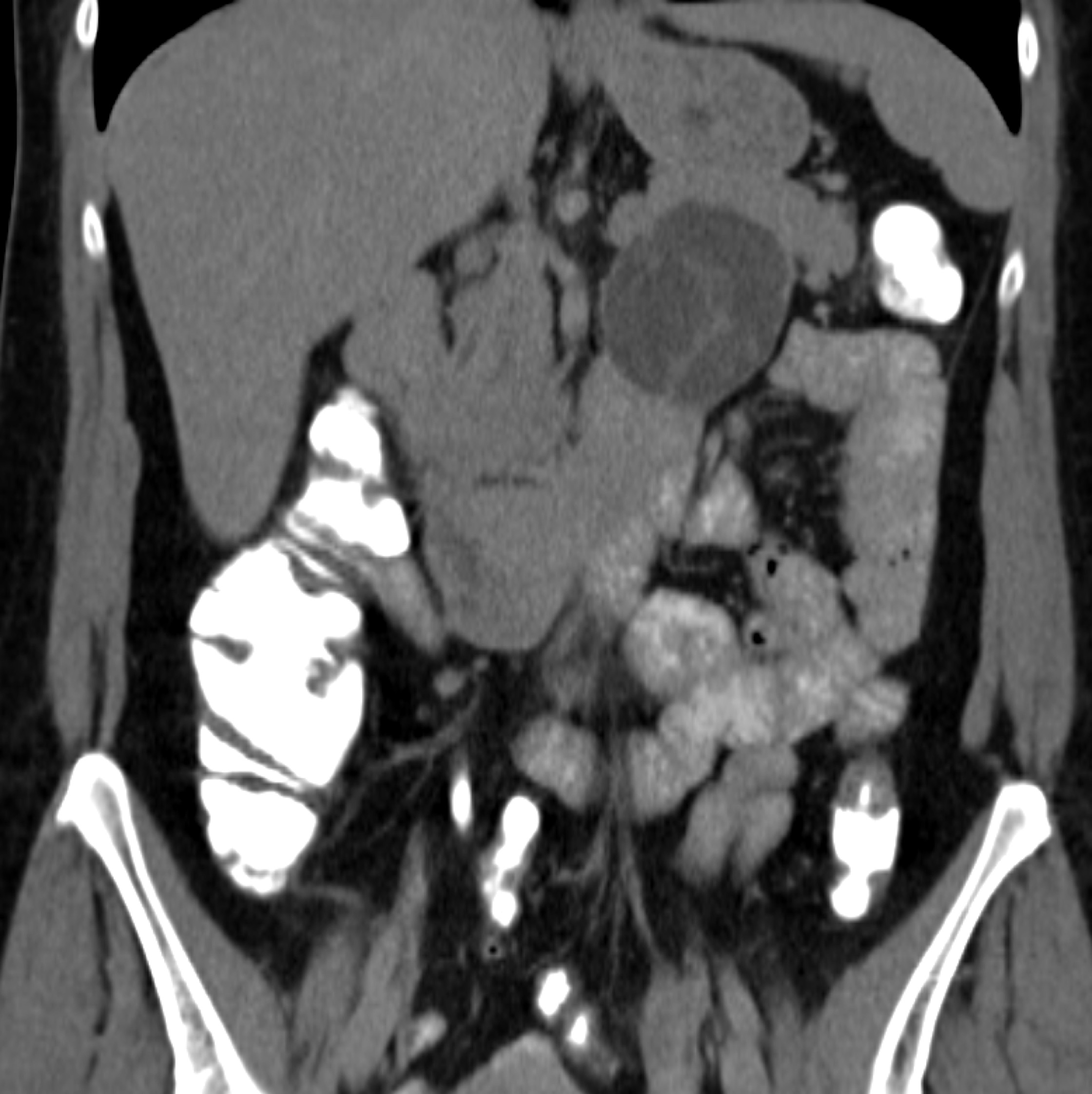 CTisus Quiz