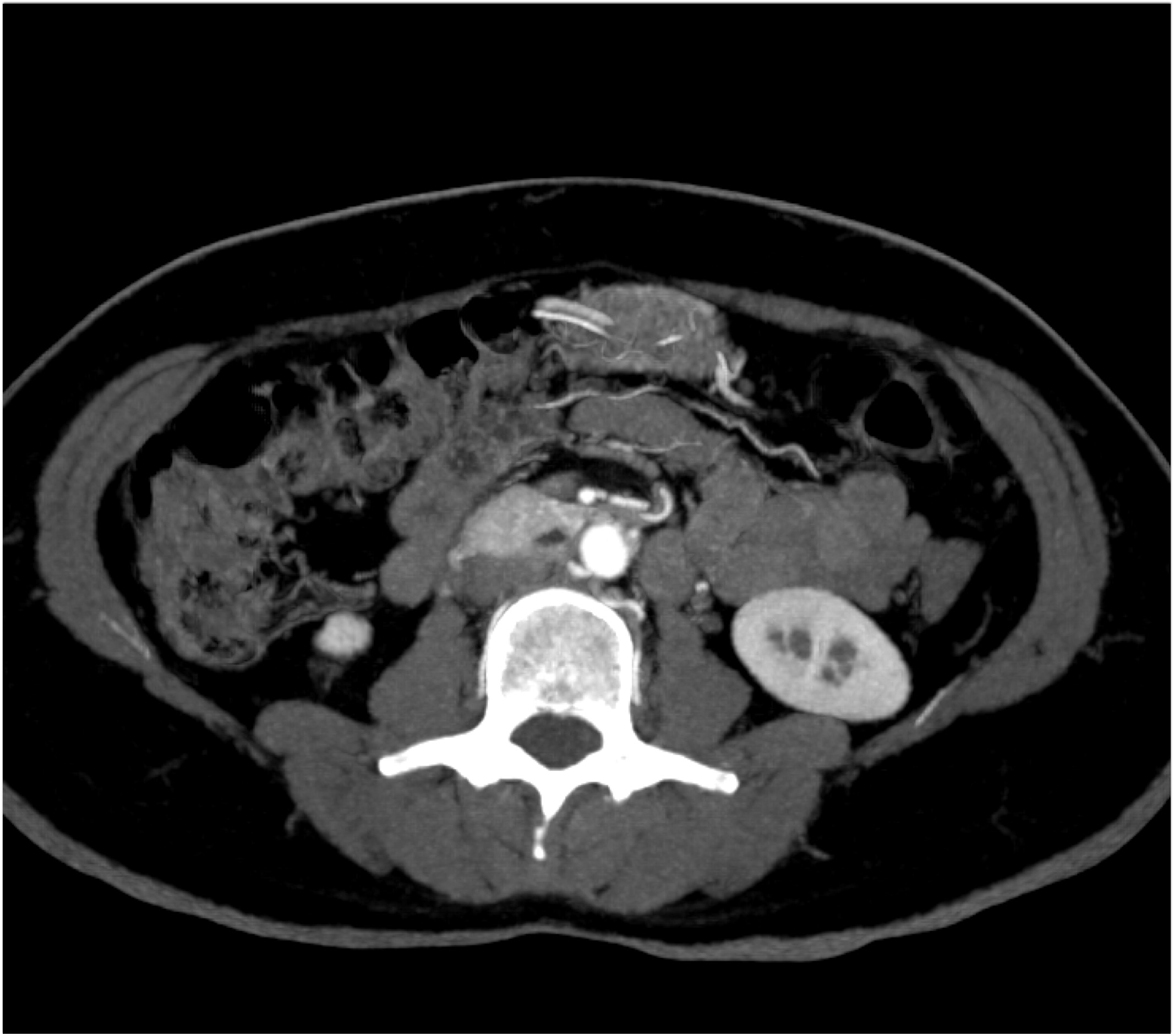 CTisus Quiz