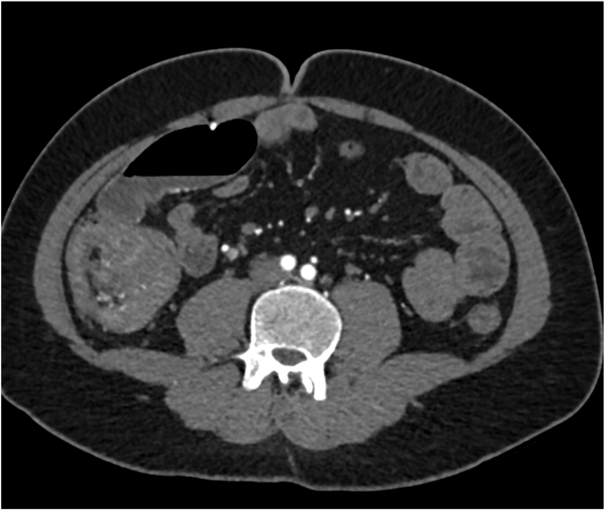 CTisus Quiz