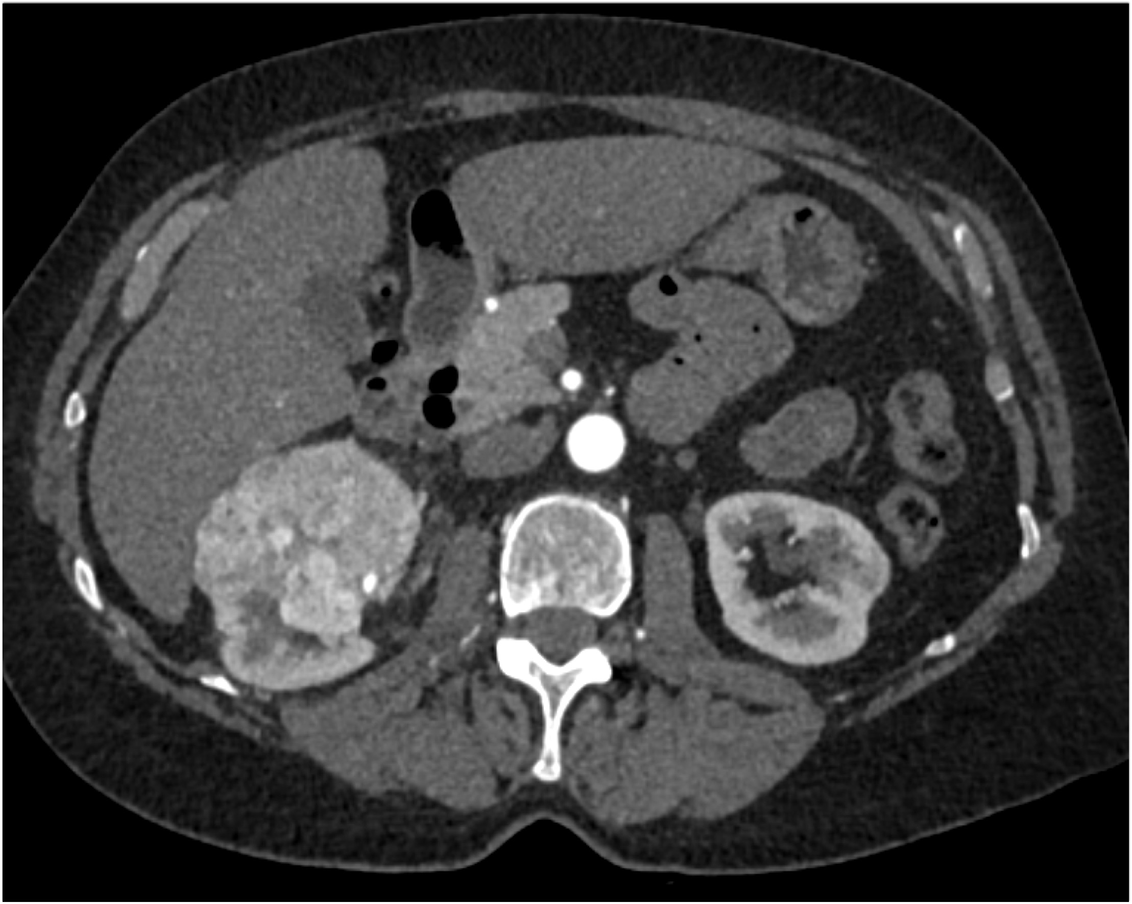 CTisus Quiz