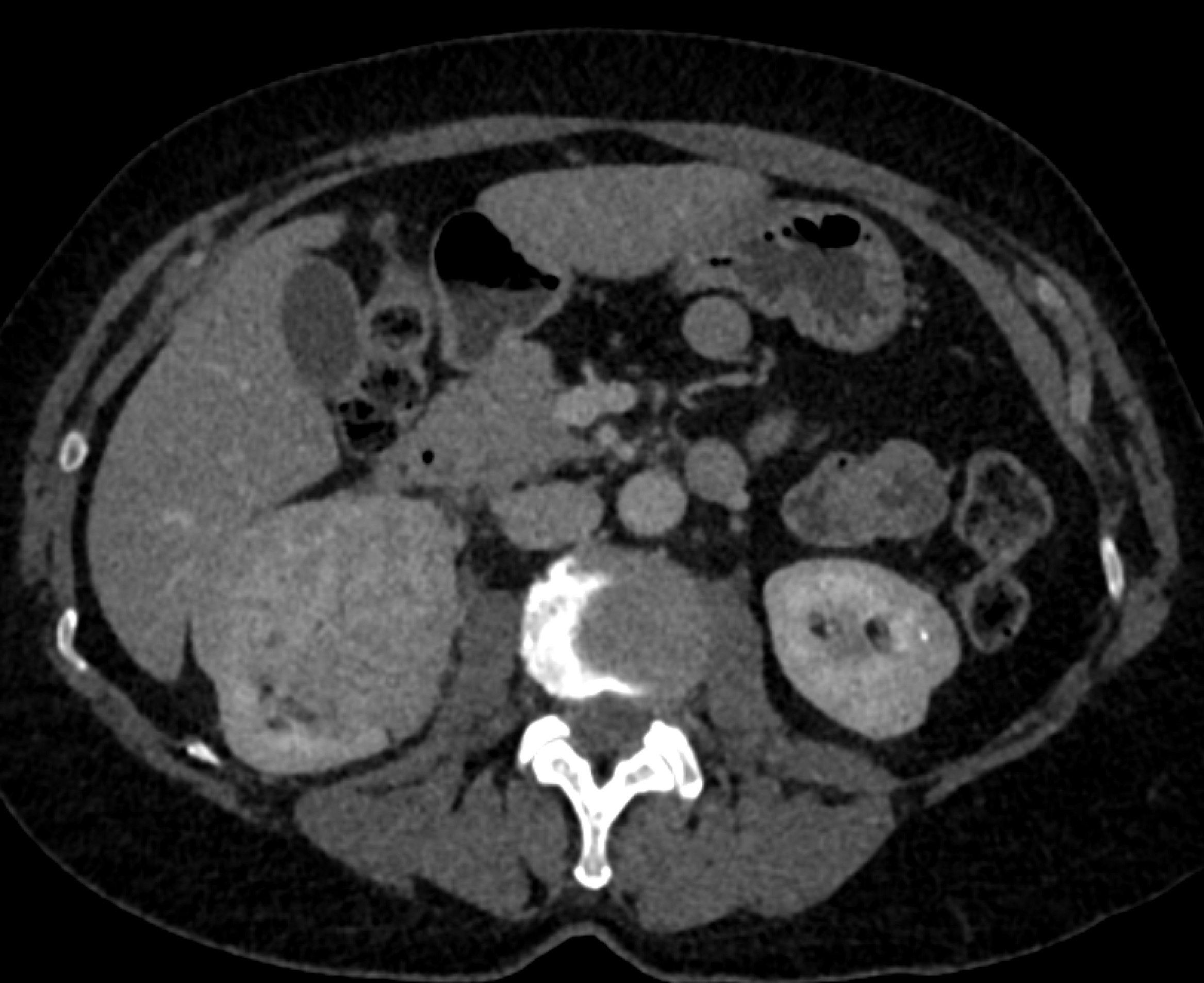 CTisus Quiz