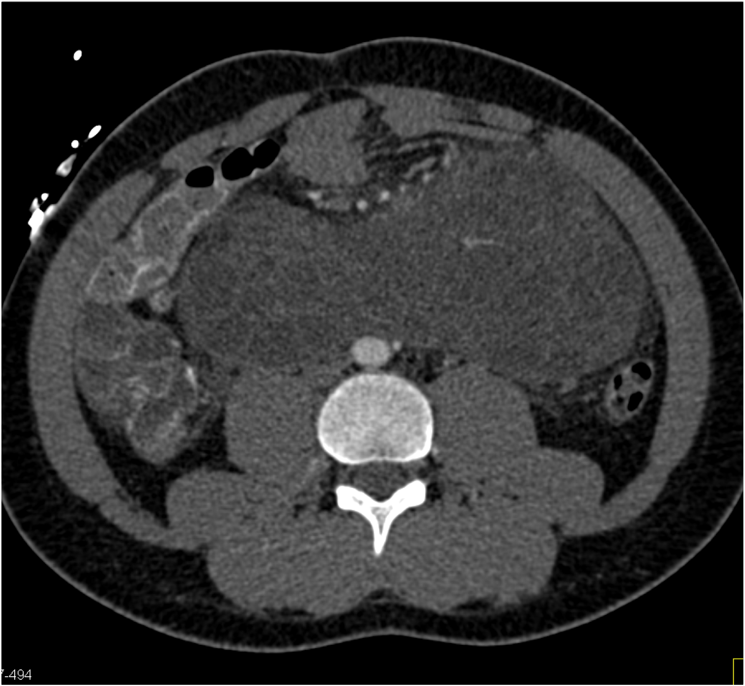 CTisus Quiz