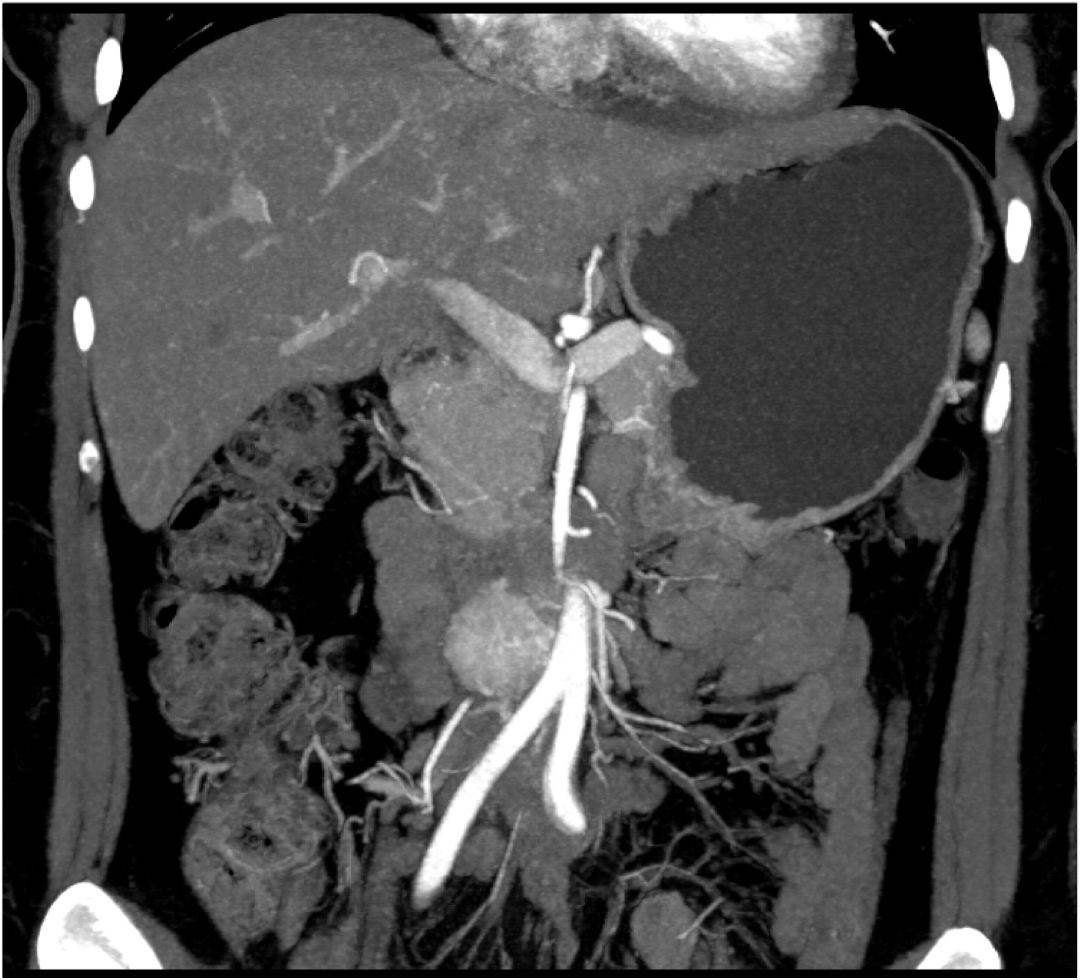 CTisus Quiz