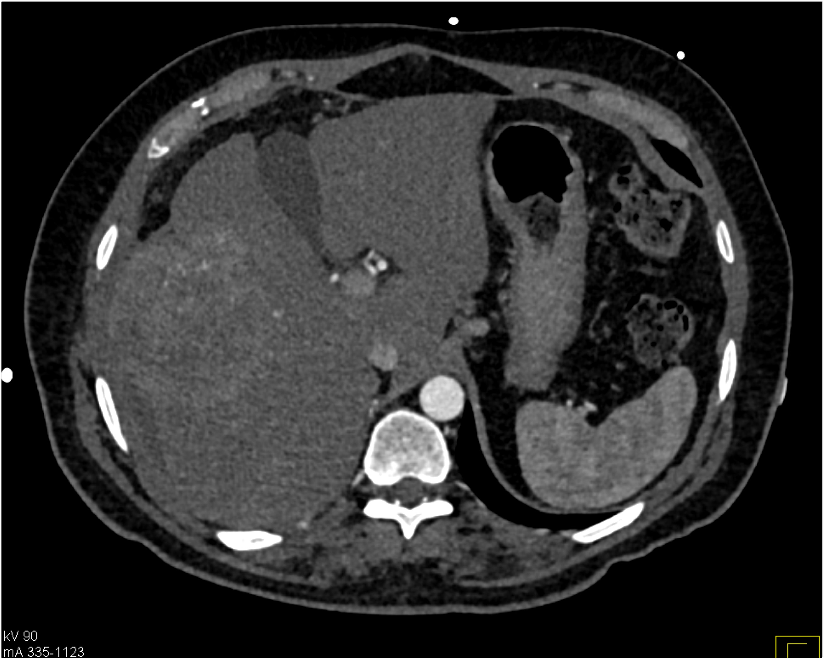 CTisus Quiz