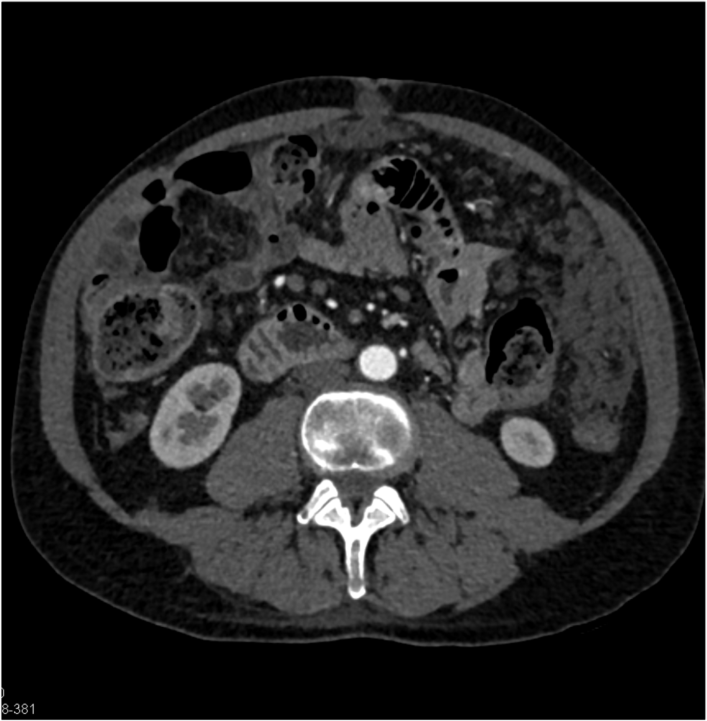 CTisus Quiz