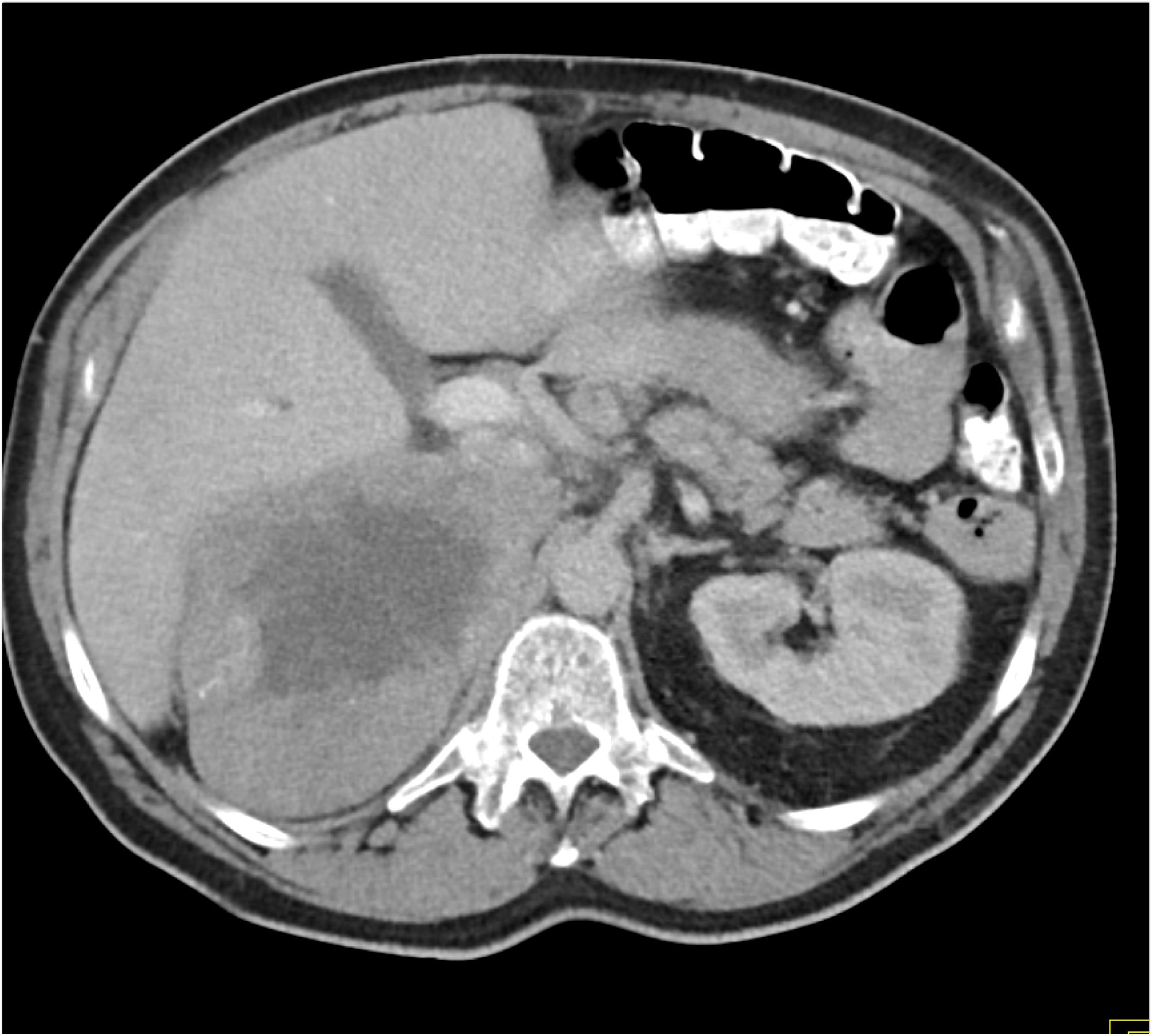 CTisus Quiz