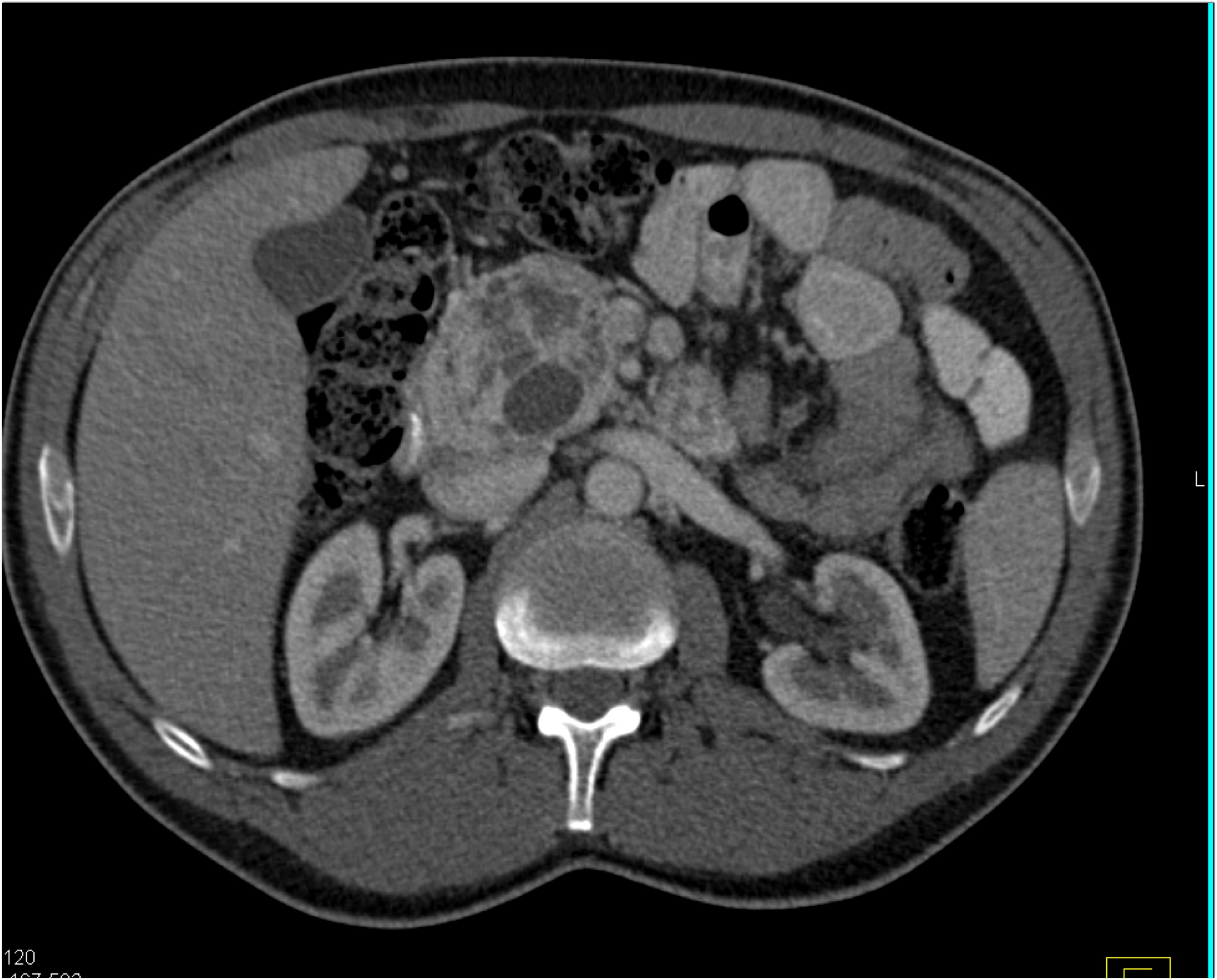 CTisus Quiz