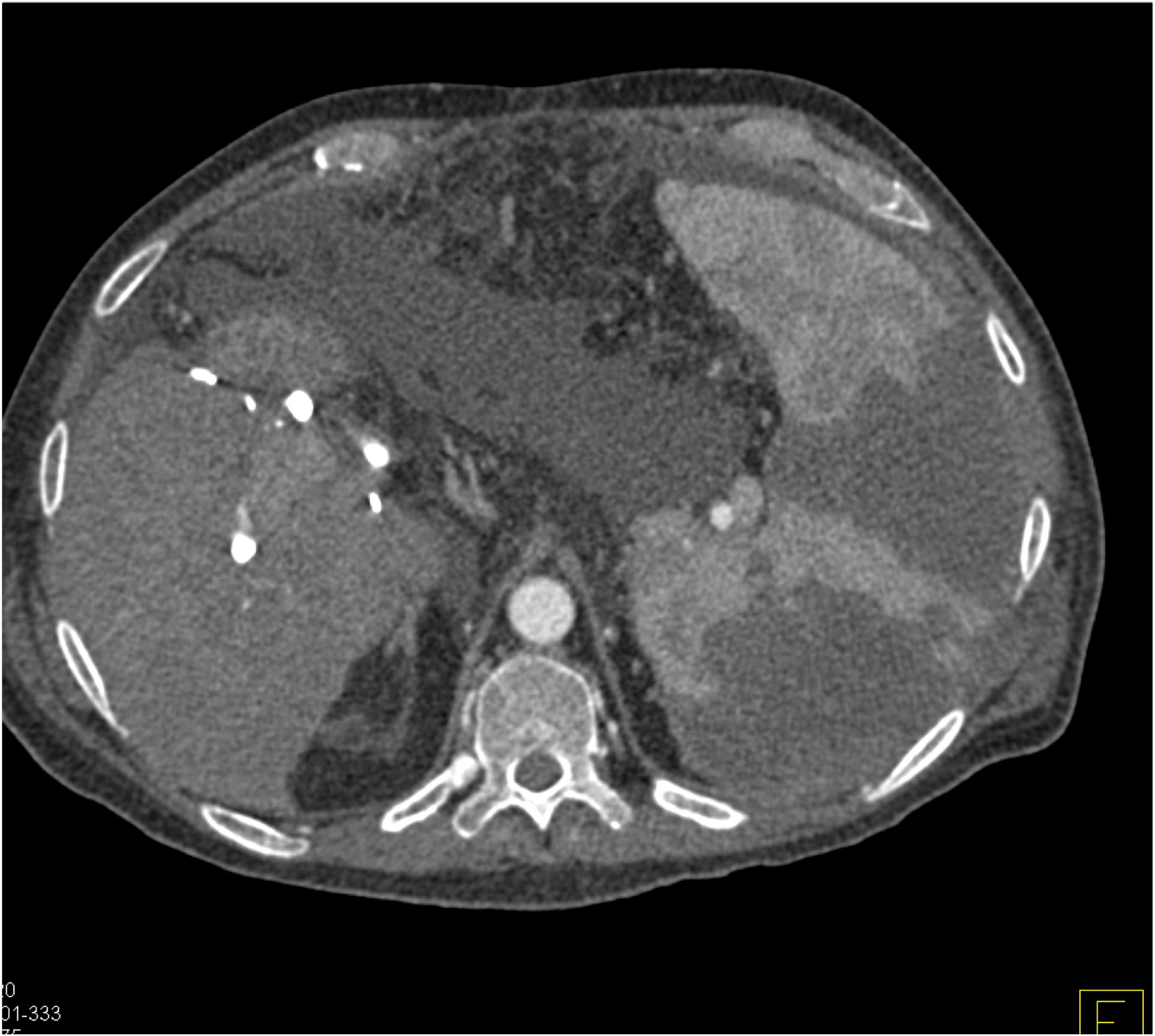 CTisus Quiz
