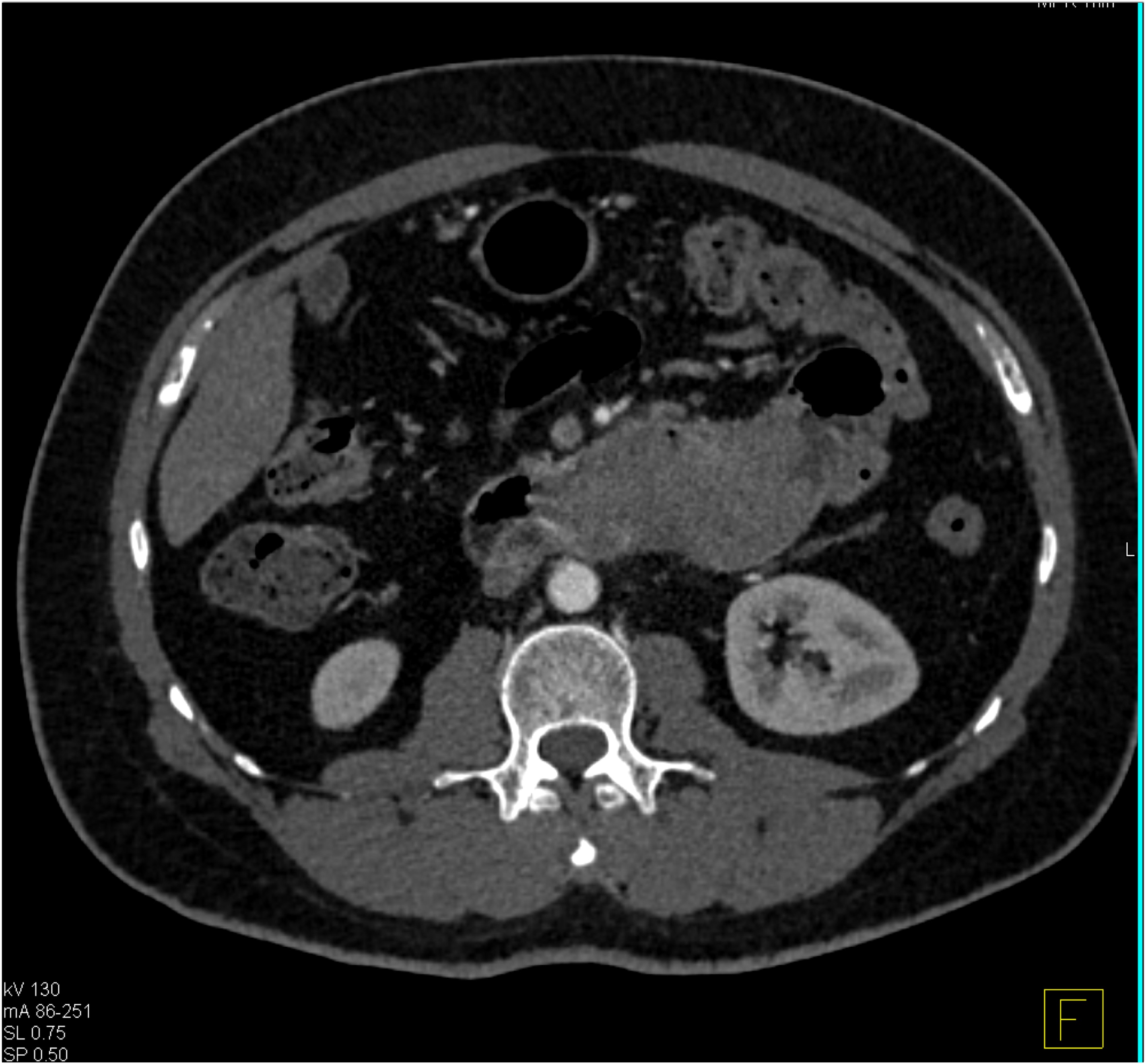 CTisus Quiz