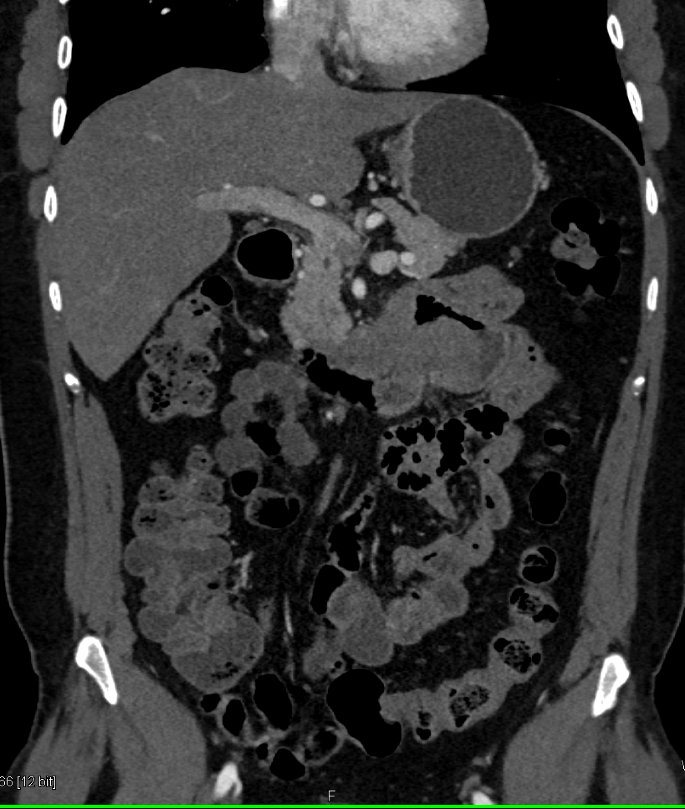 CTisus Quiz