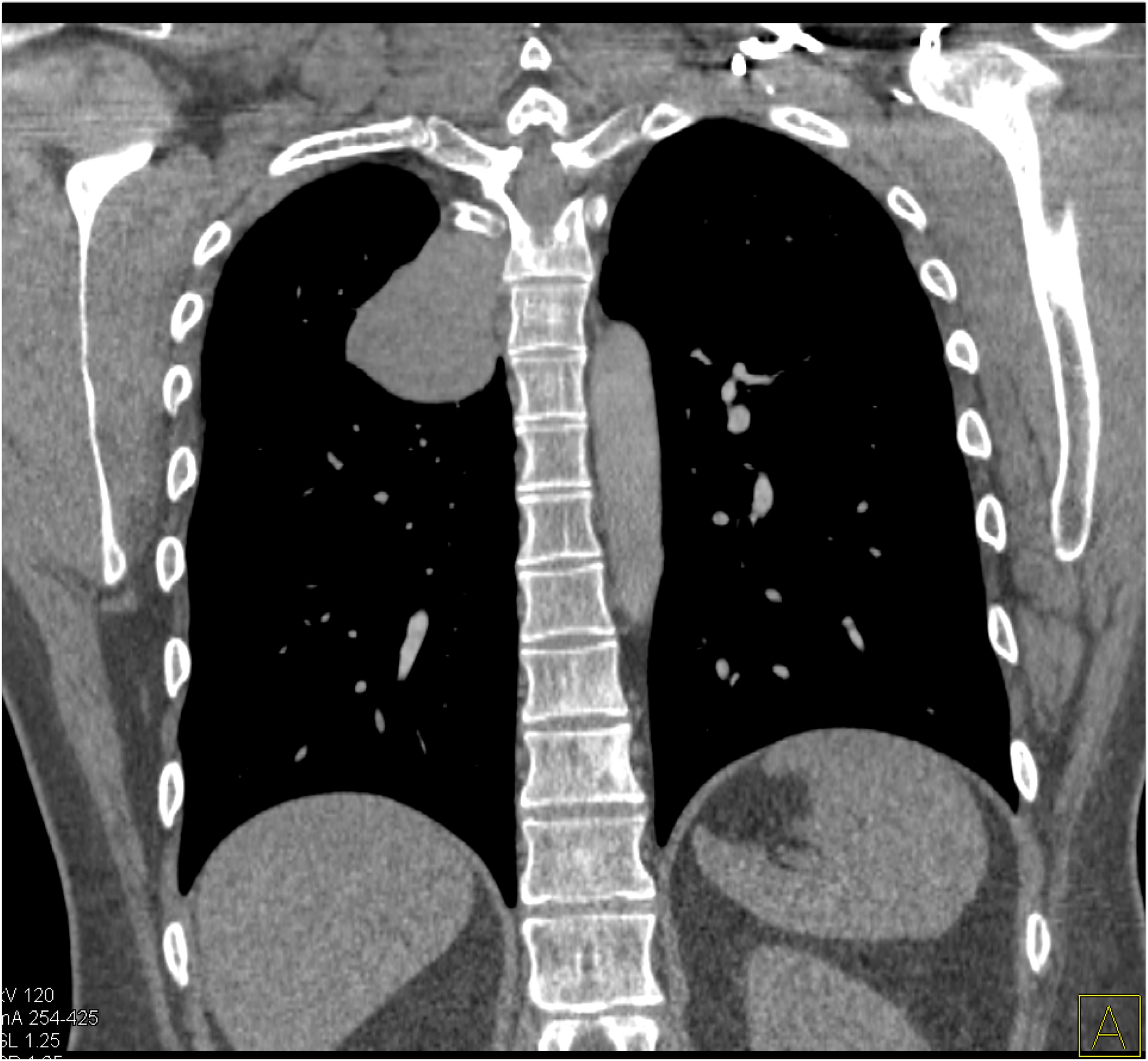 CTisus Quiz