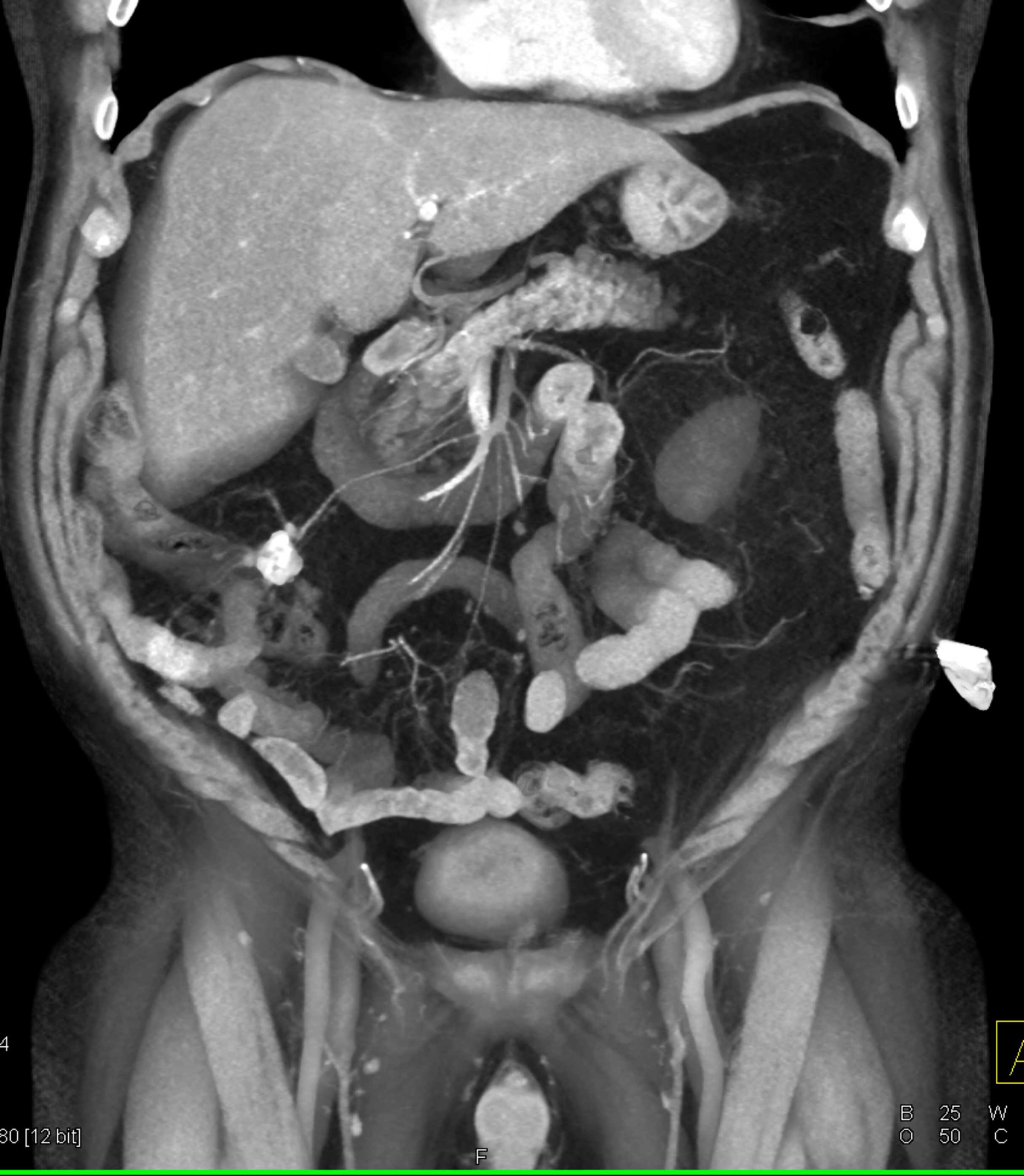 CTisus Quiz