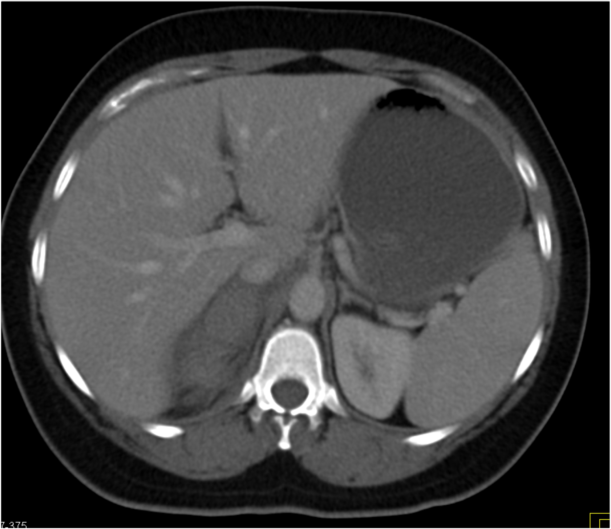 CTisus Quiz