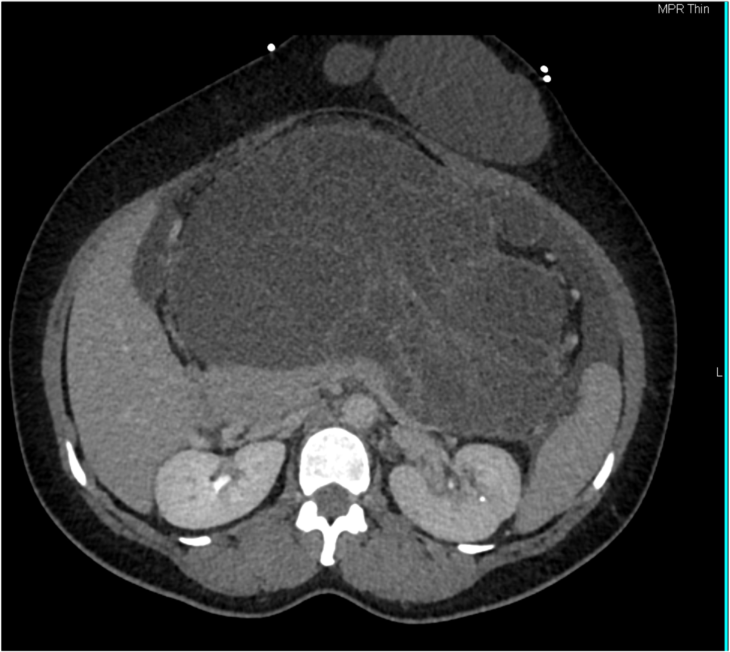 CTisus Quiz