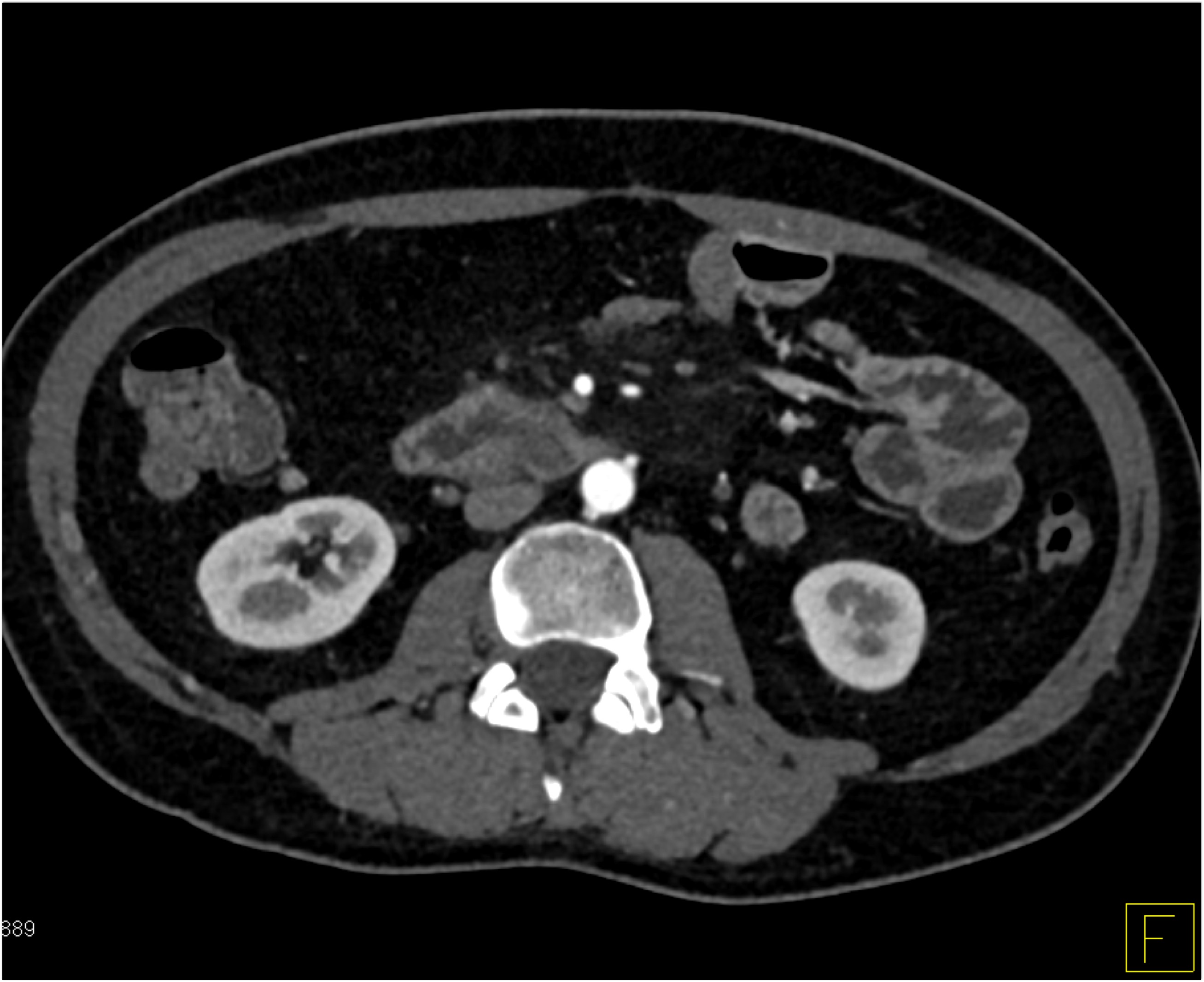 CTisus Quiz