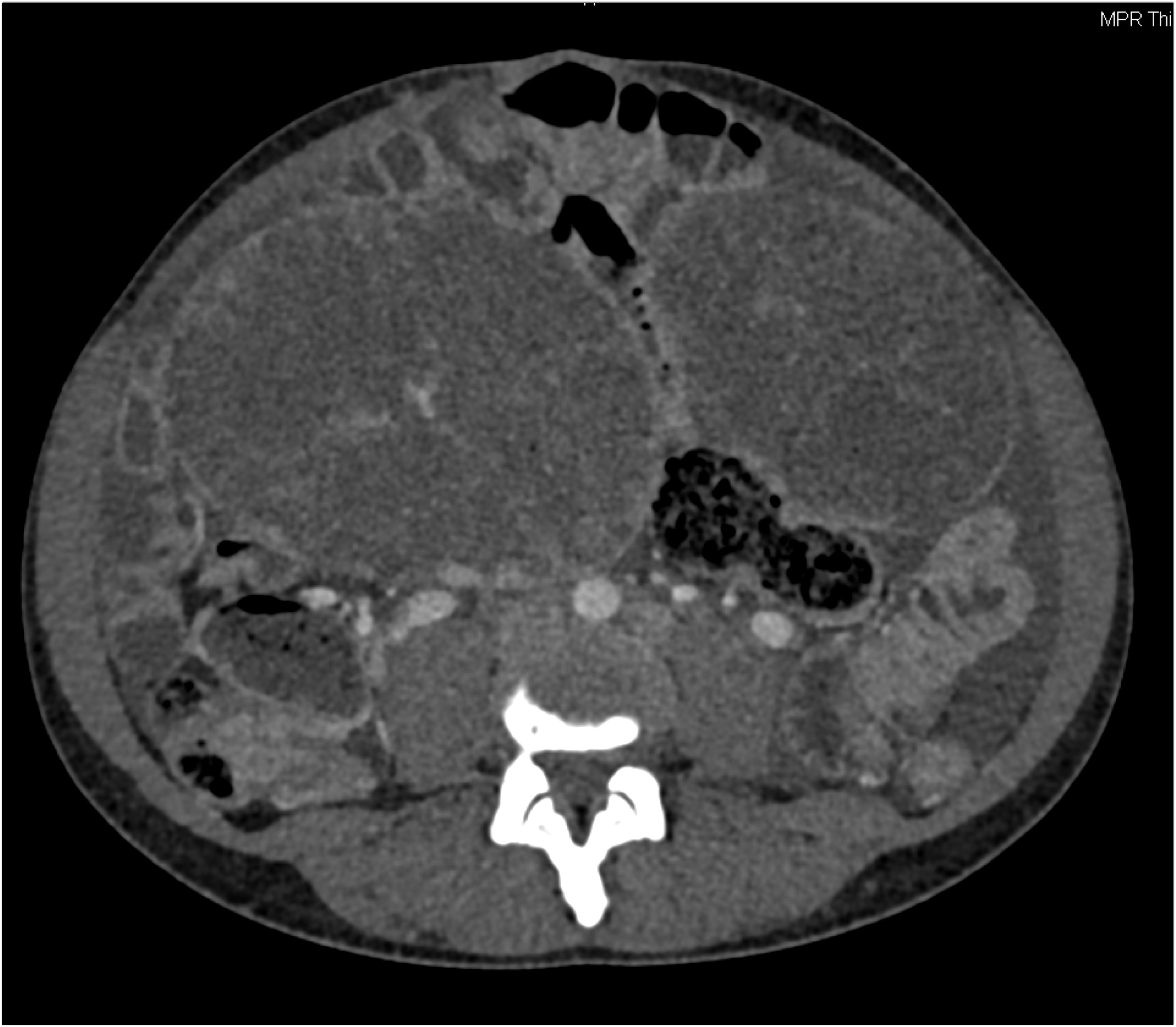 CTisus Quiz