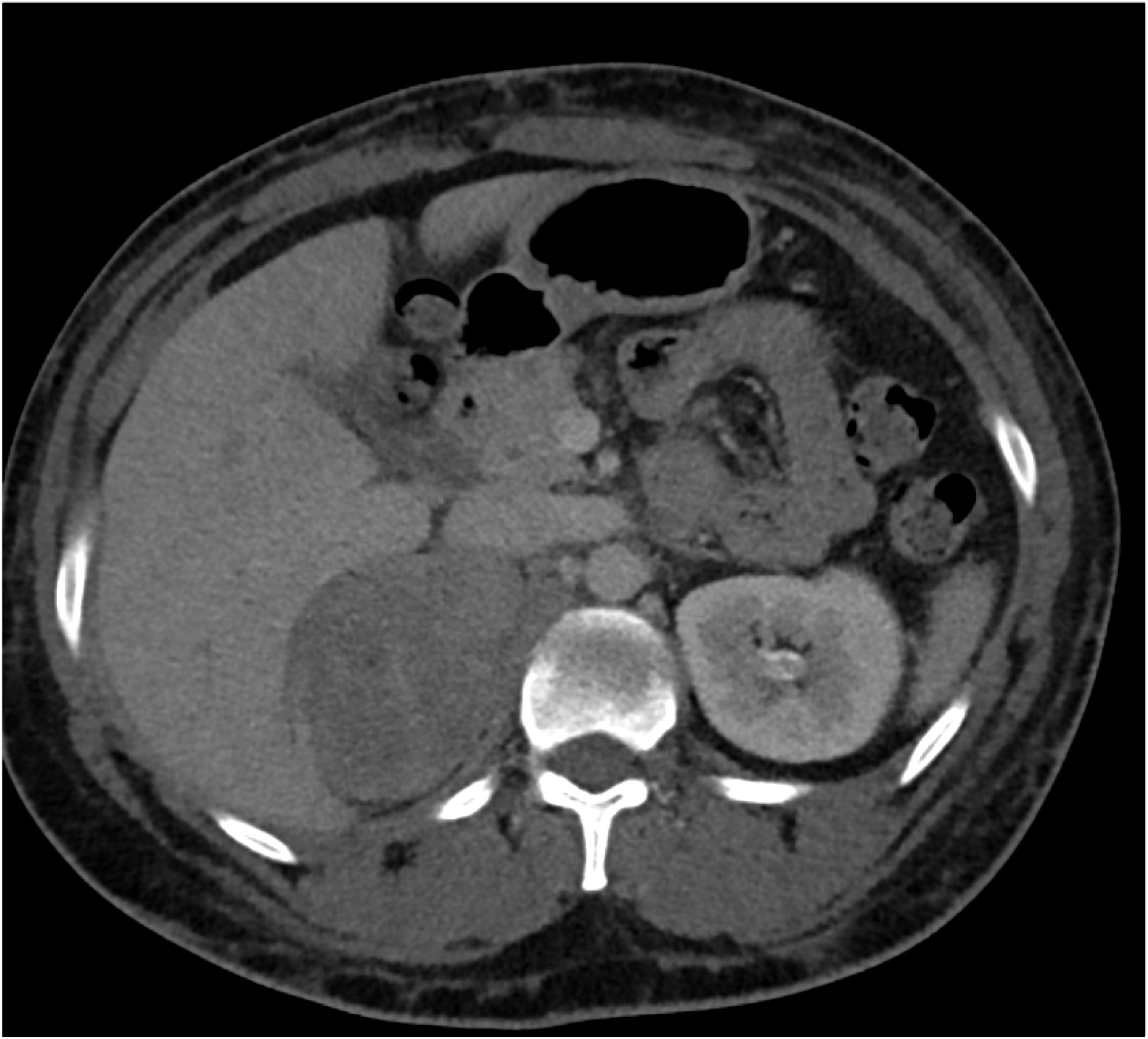 CTisus Quiz