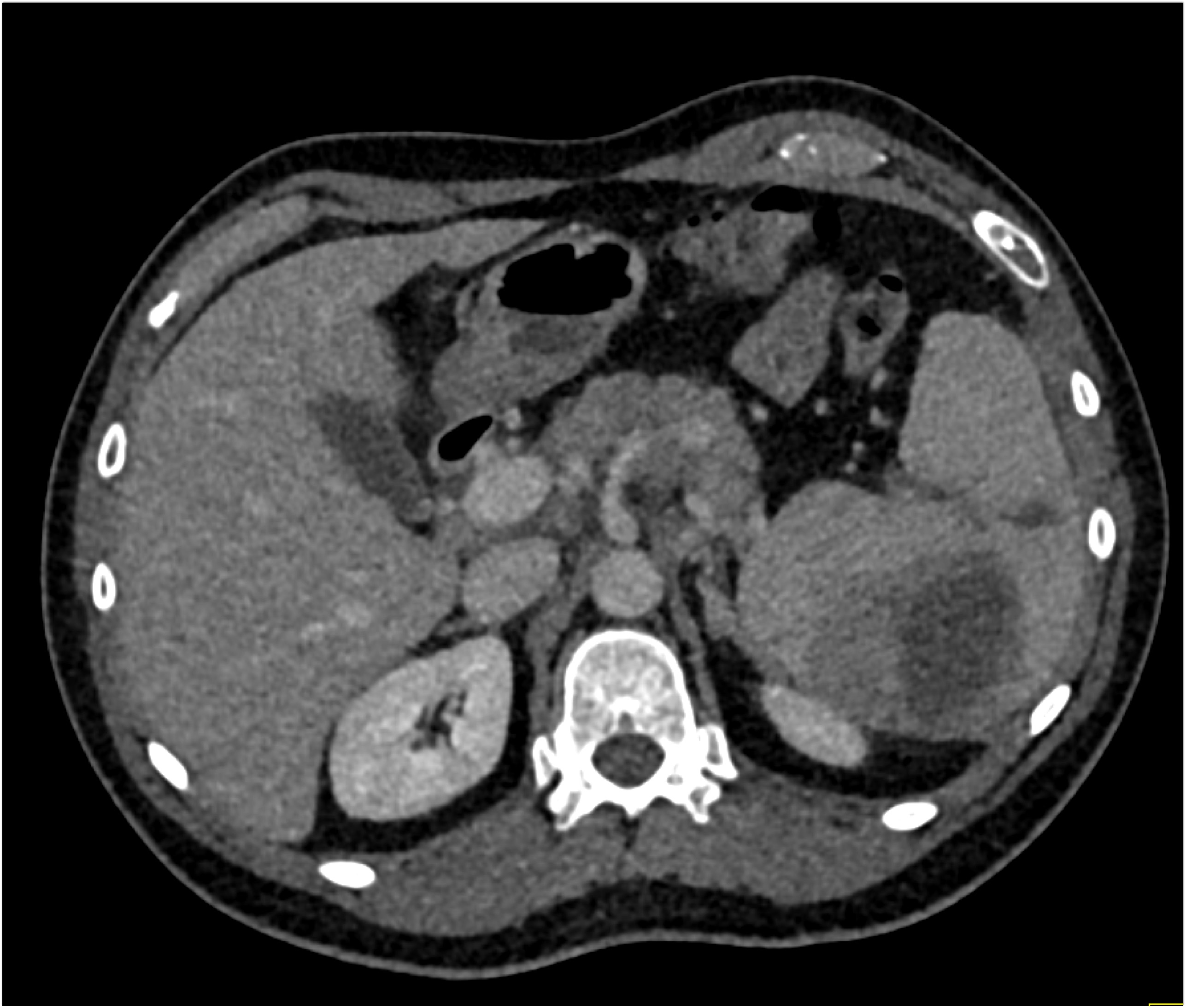 CTisus Quiz