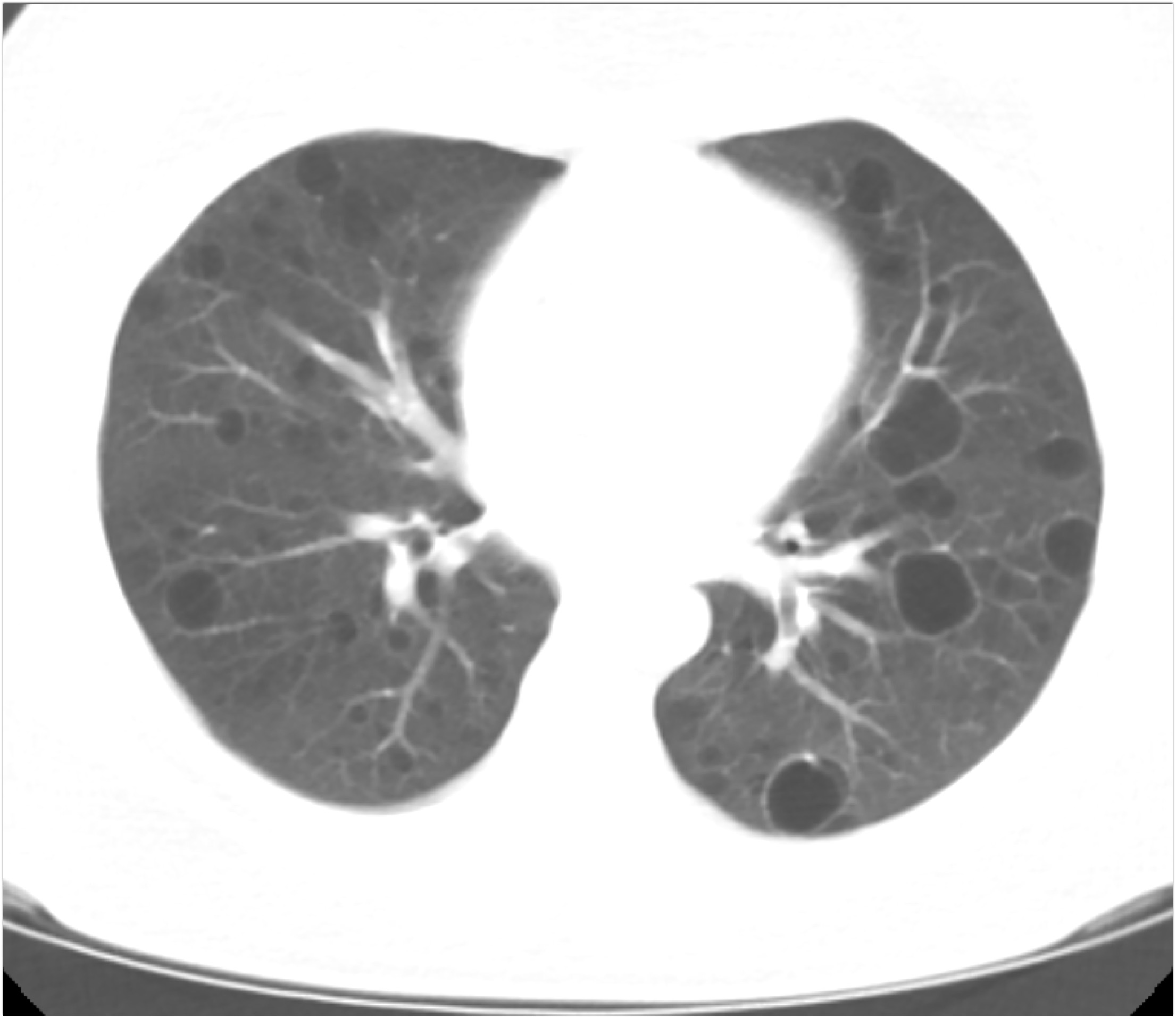 CTisus Quiz