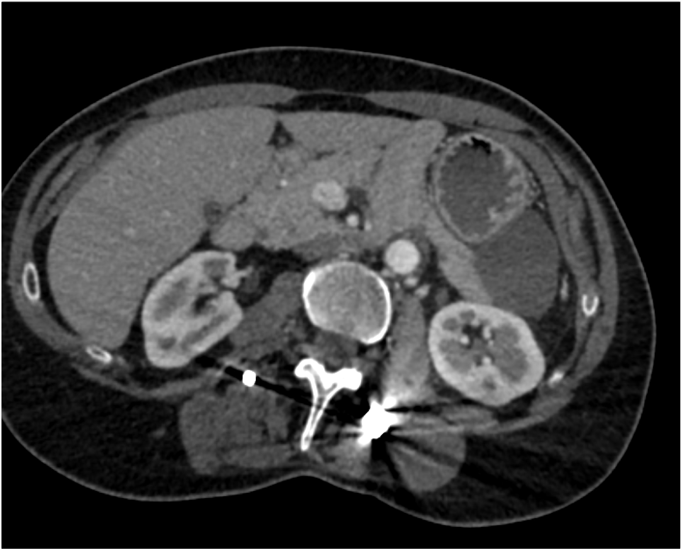 CTisus Quiz