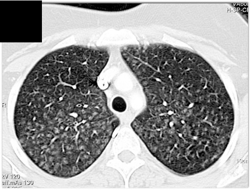 CTisus Quiz