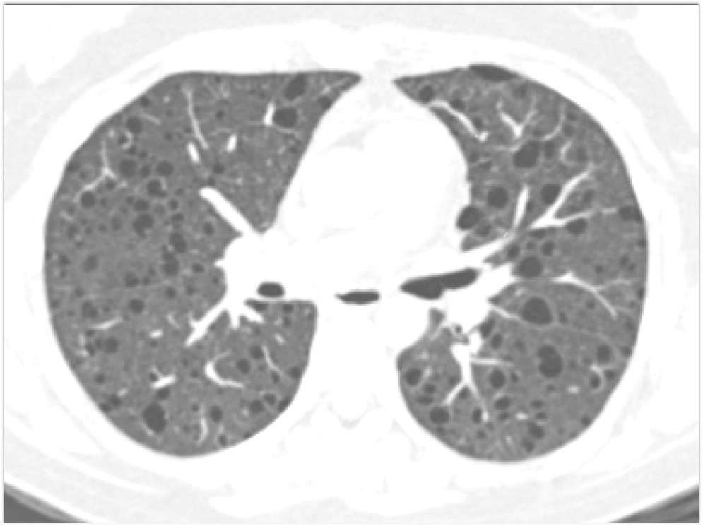 CTisus Quiz