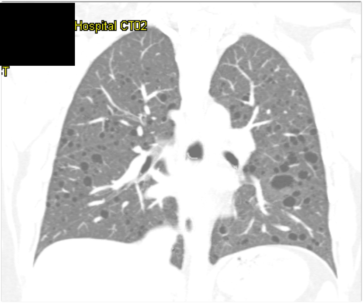 CTisus Quiz