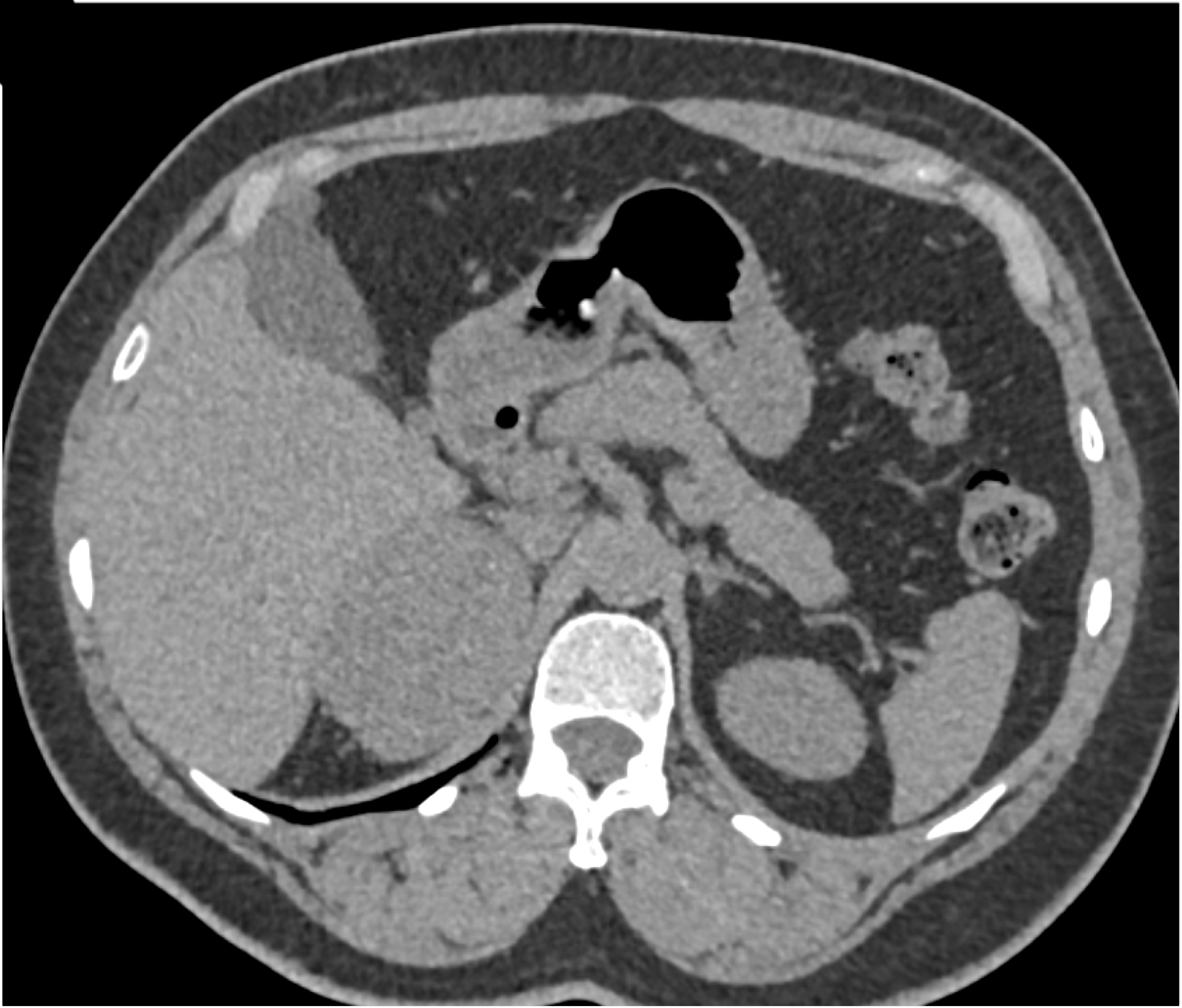 CTisus Quiz