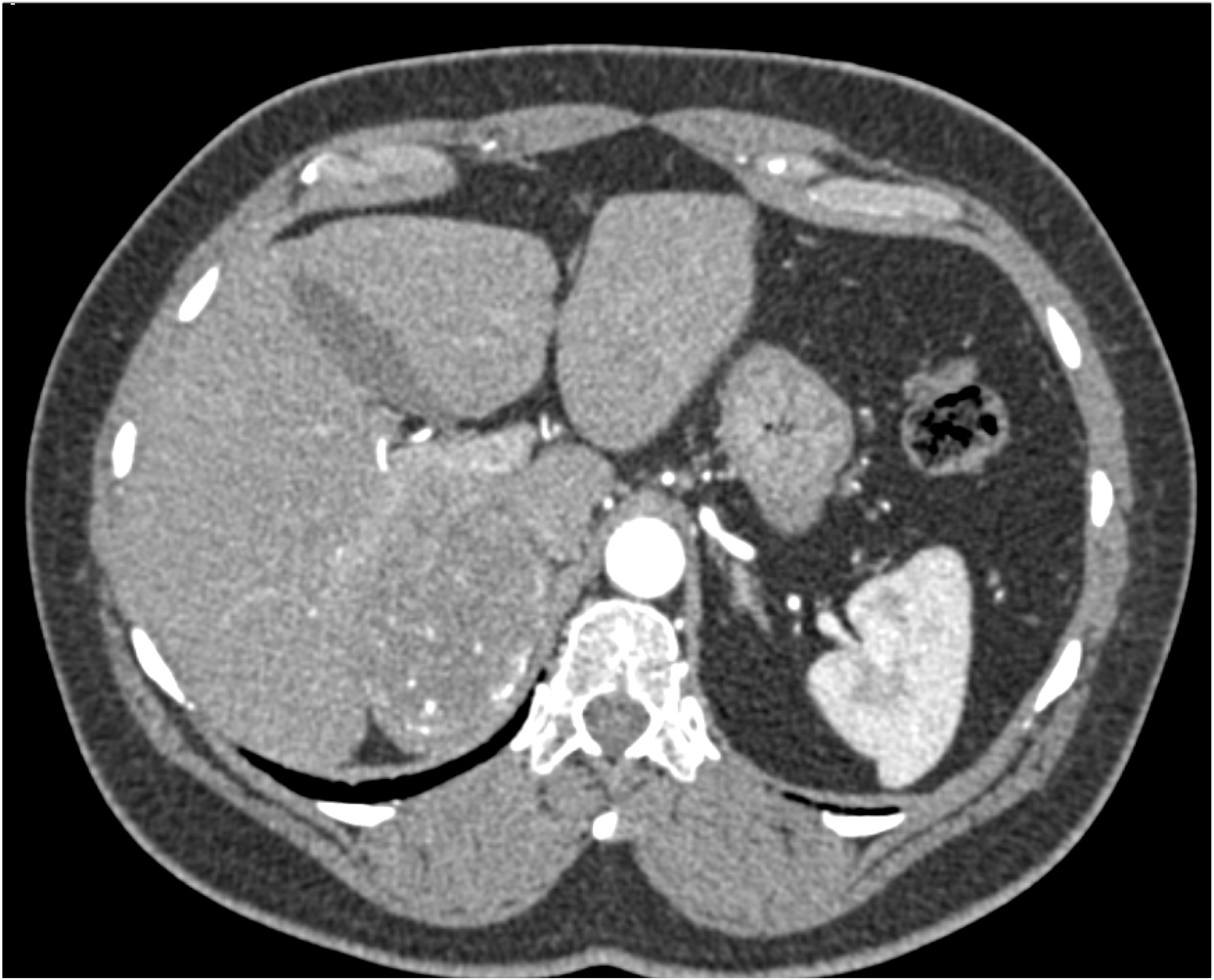 CTisus Quiz