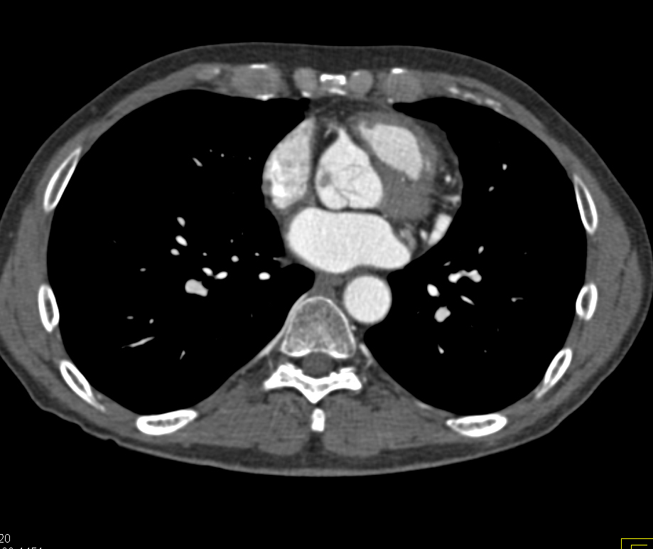 CTisus Quiz