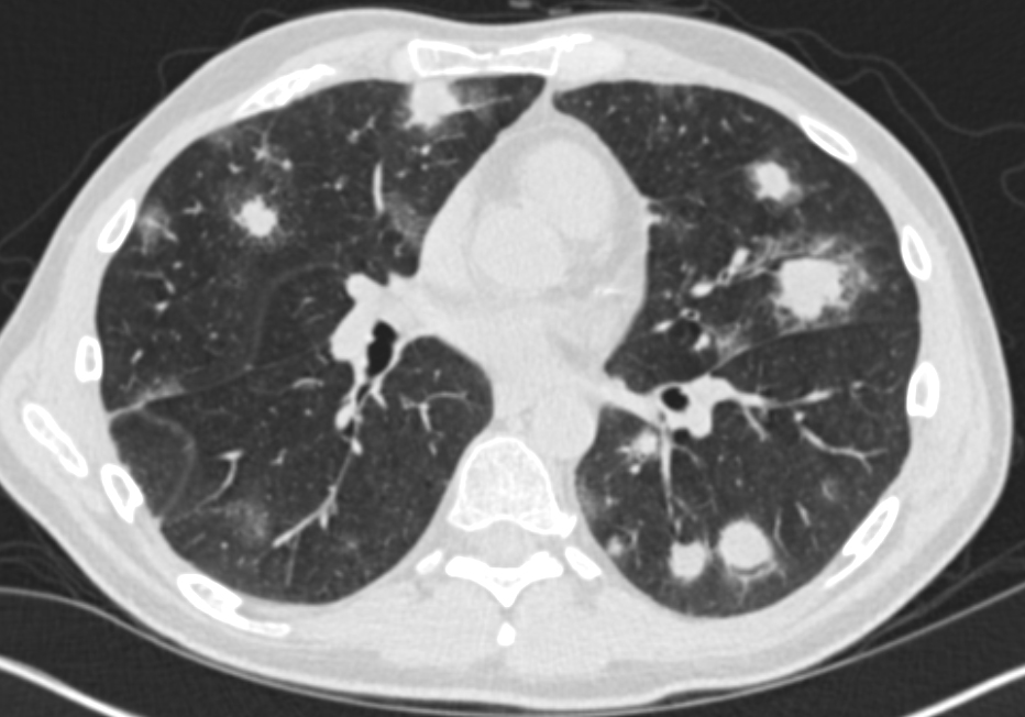 CTisus Quiz