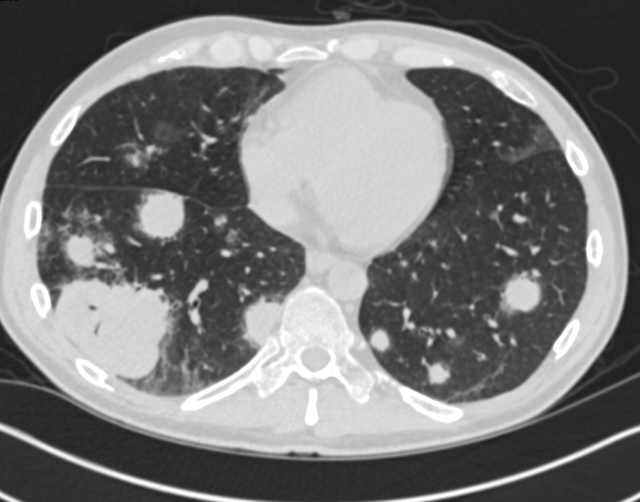 CTisus Quiz