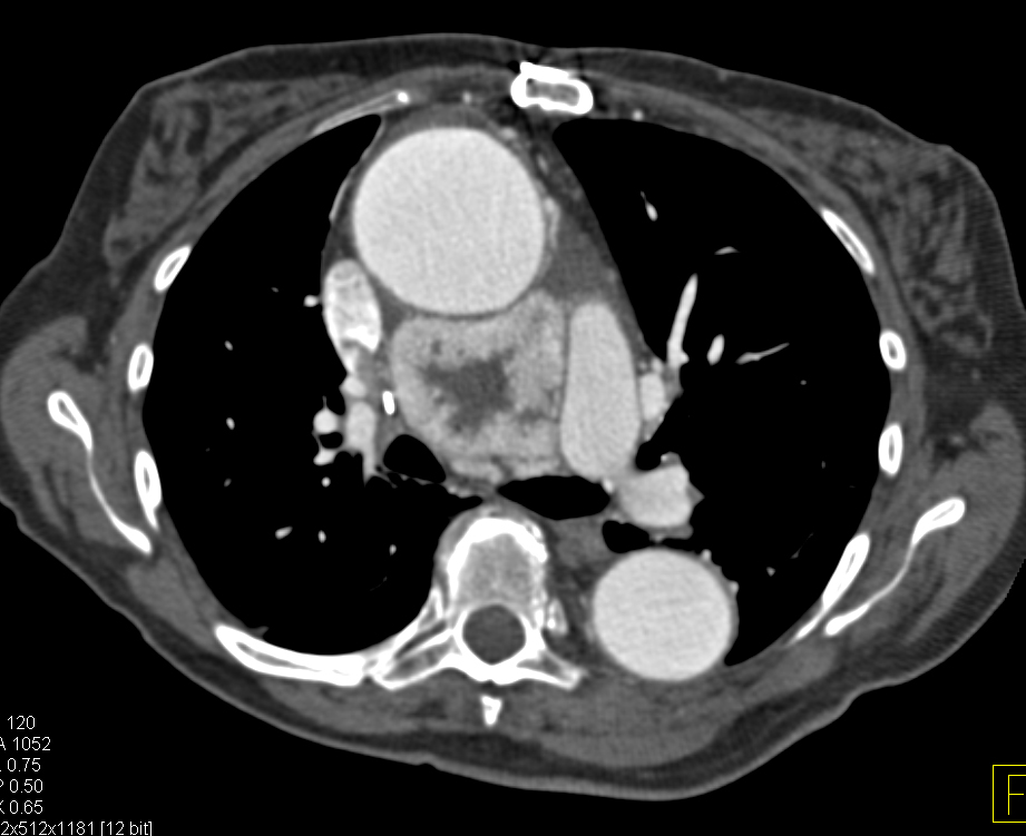 CTisus Quiz